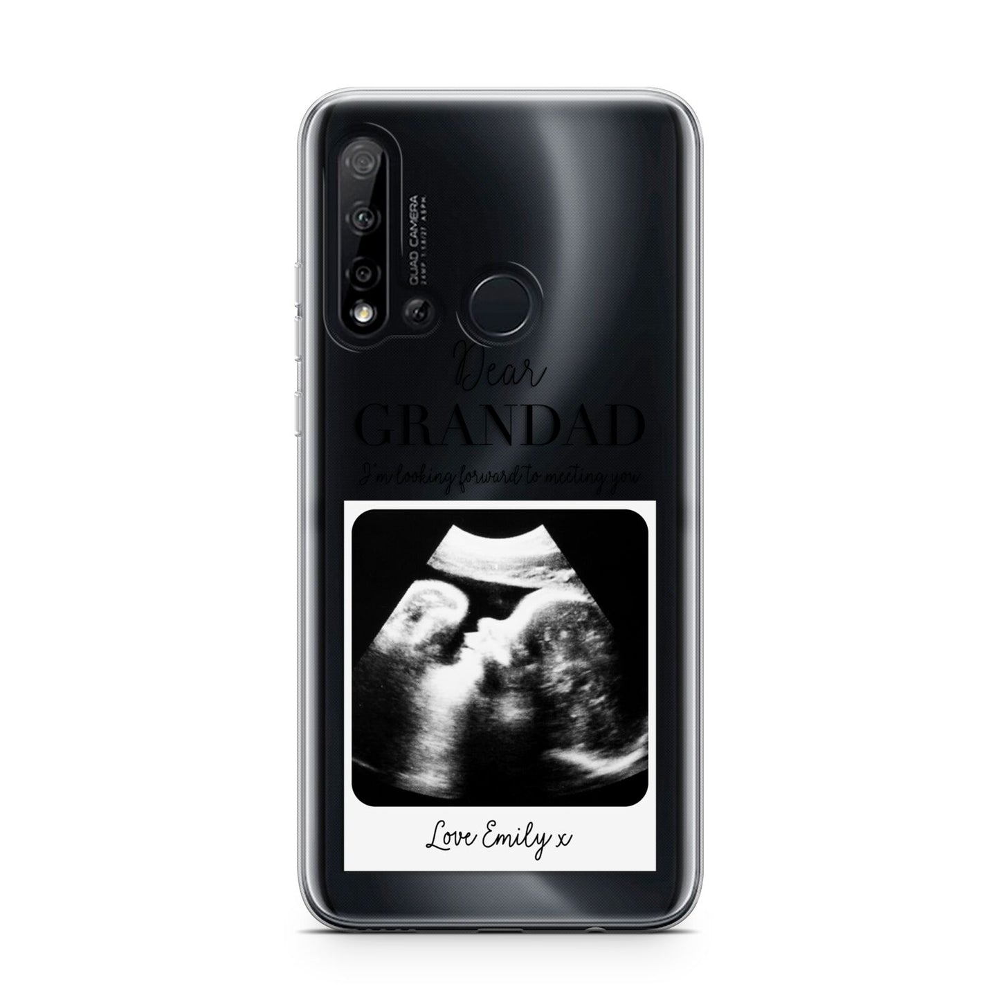 Personalised Baby Scan Photo Upload Huawei P20 Lite 5G Phone Case