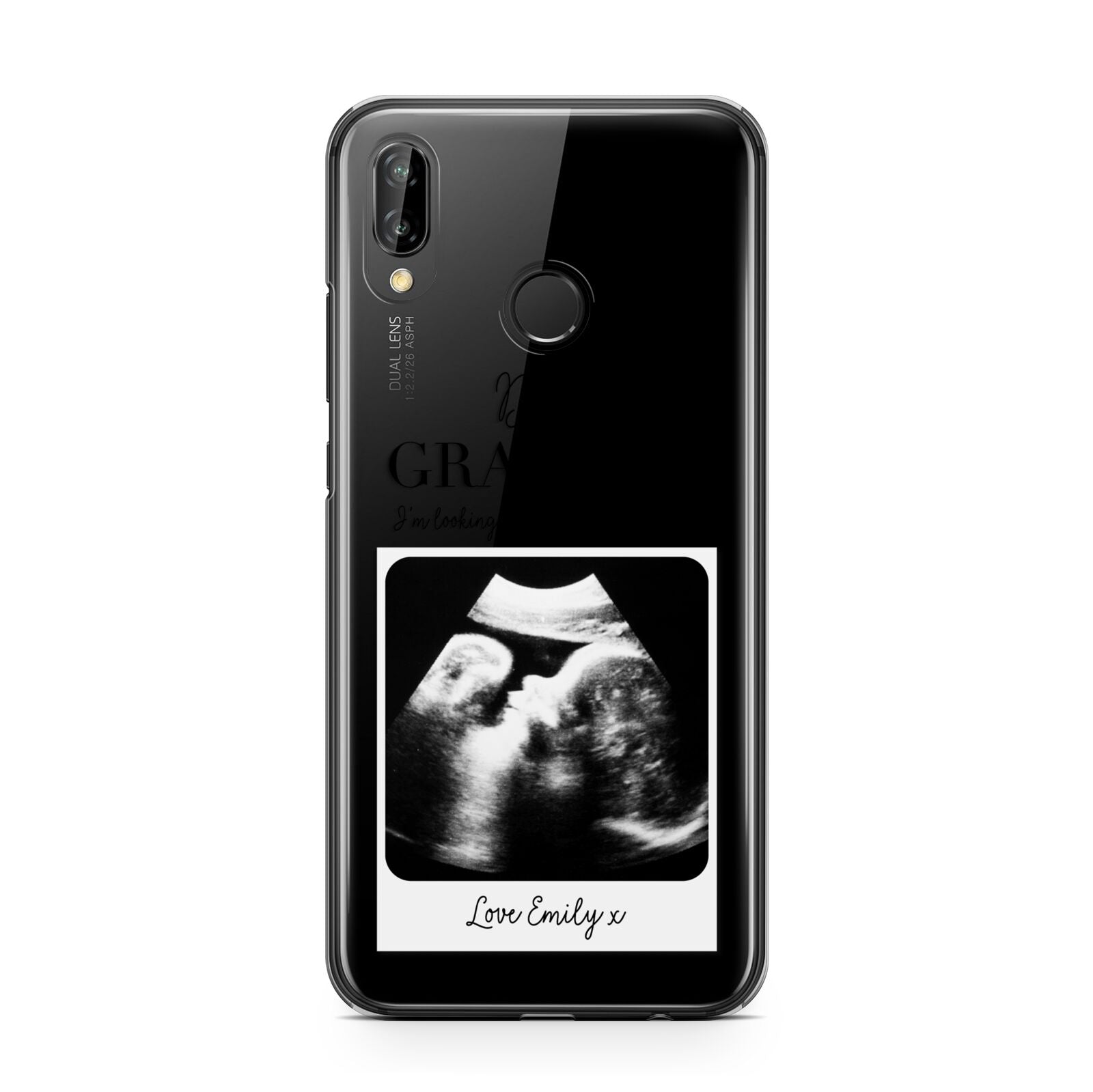 Personalised Baby Scan Photo Upload Huawei P20 Lite Phone Case