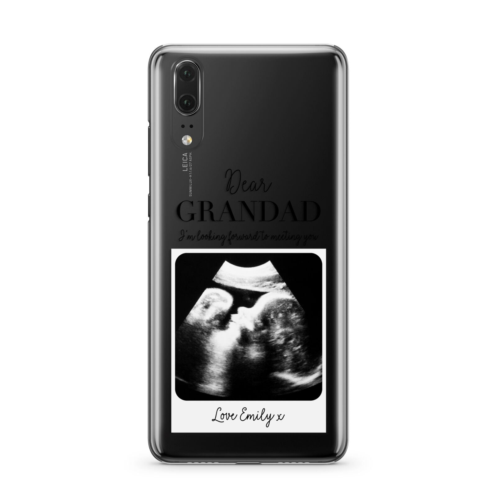 Personalised Baby Scan Photo Upload Huawei P20 Phone Case