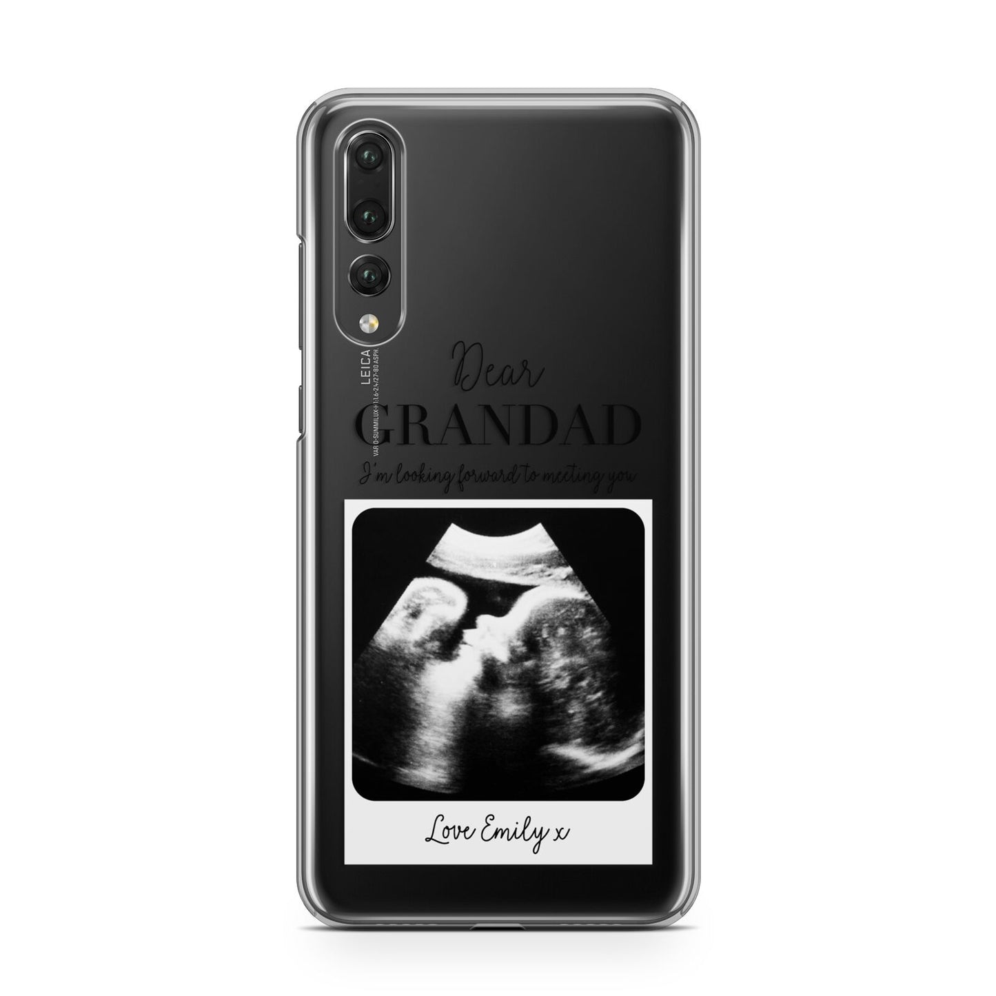 Personalised Baby Scan Photo Upload Huawei P20 Pro Phone Case