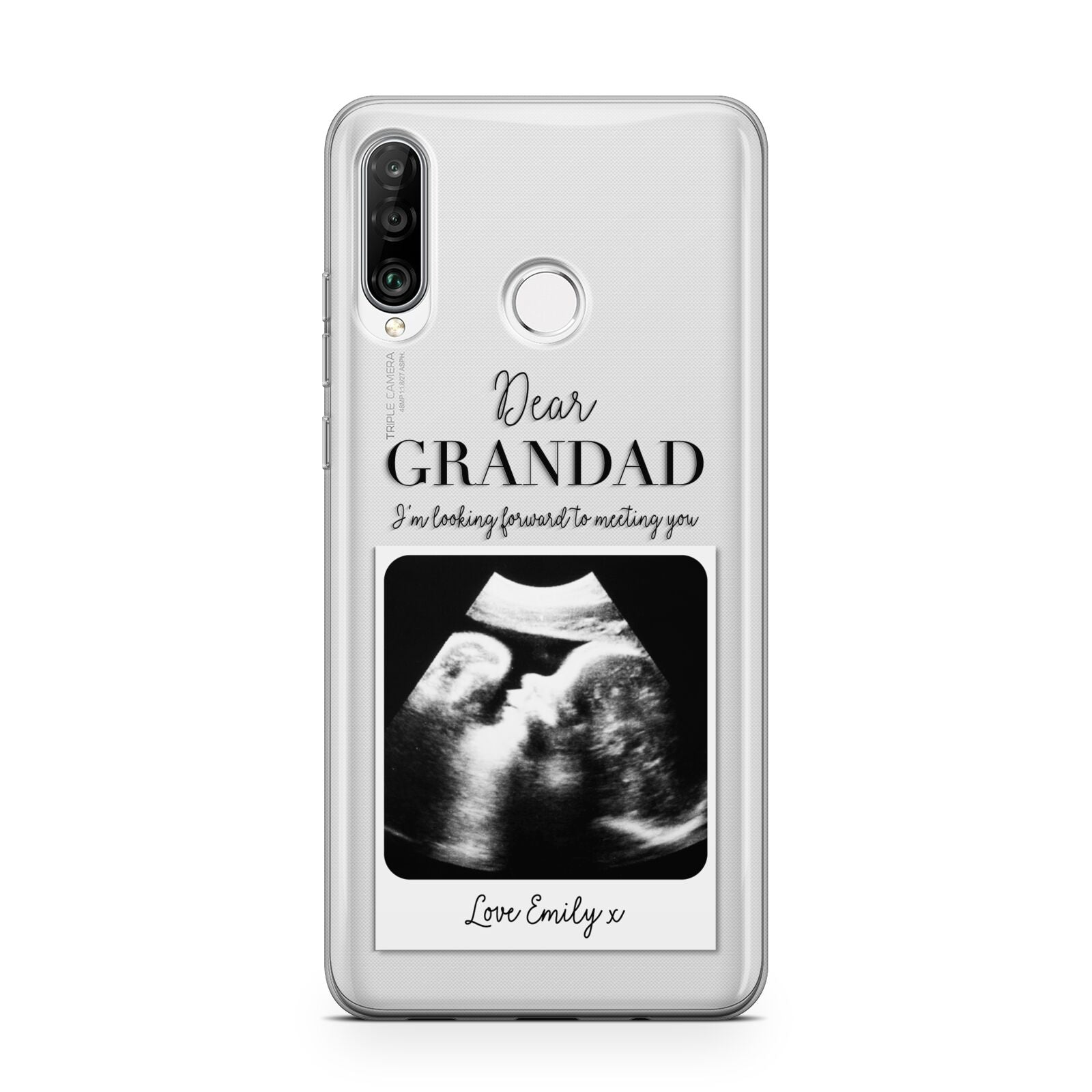 Personalised Baby Scan Photo Upload Huawei P30 Lite Phone Case