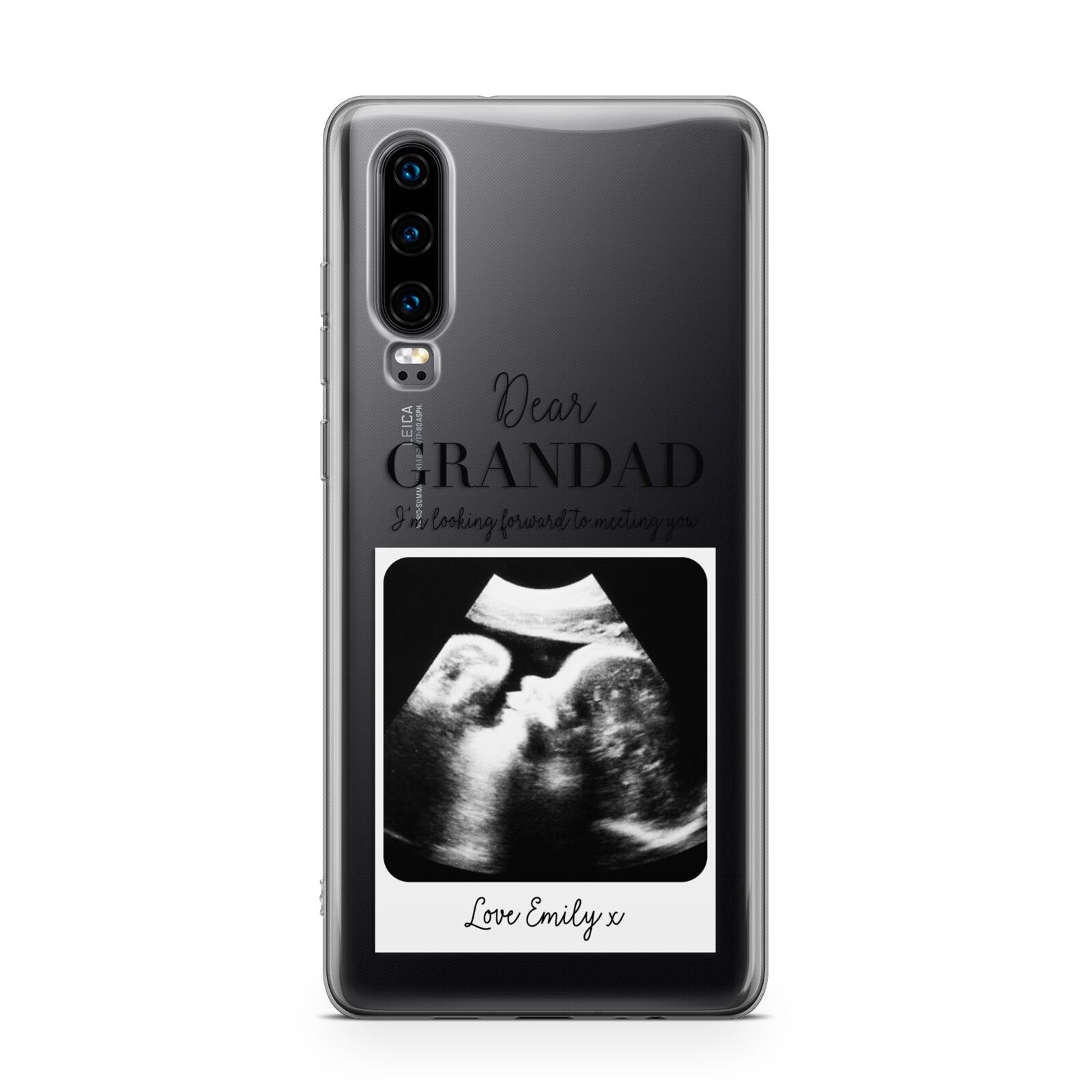 Personalised Baby Scan Photo Upload Huawei P30 Phone Case