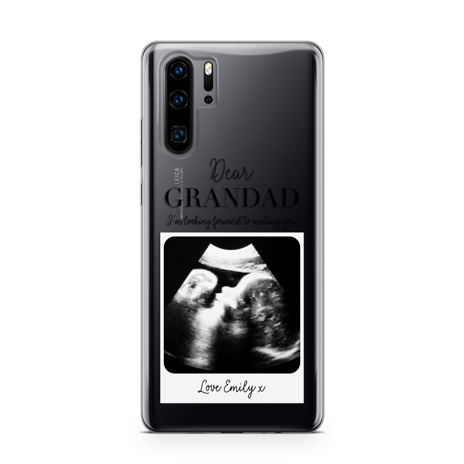 Personalised Baby Scan Photo Upload Huawei P30 Pro Phone Case