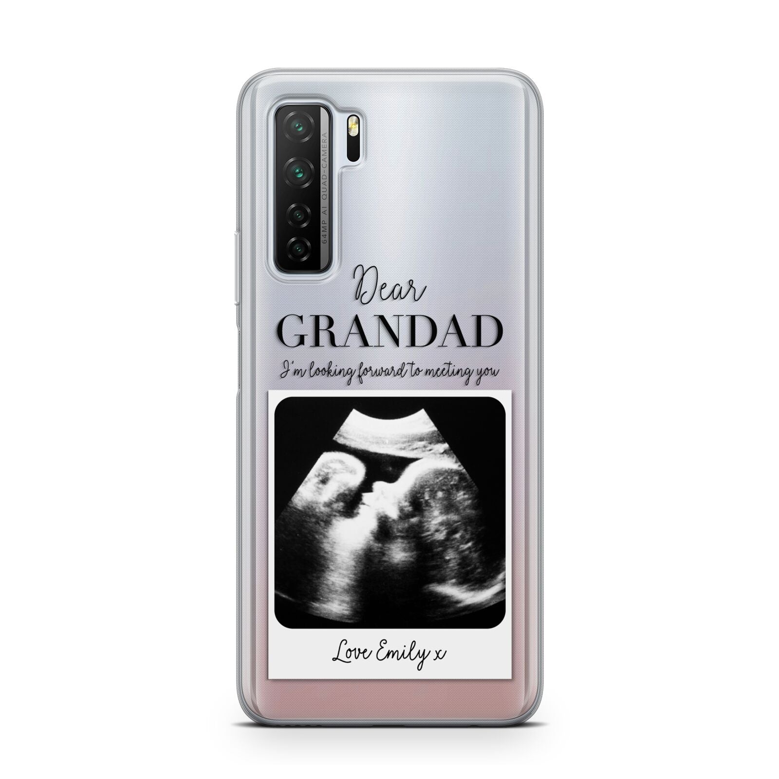 Personalised Baby Scan Photo Upload Huawei P40 Lite 5G Phone Case