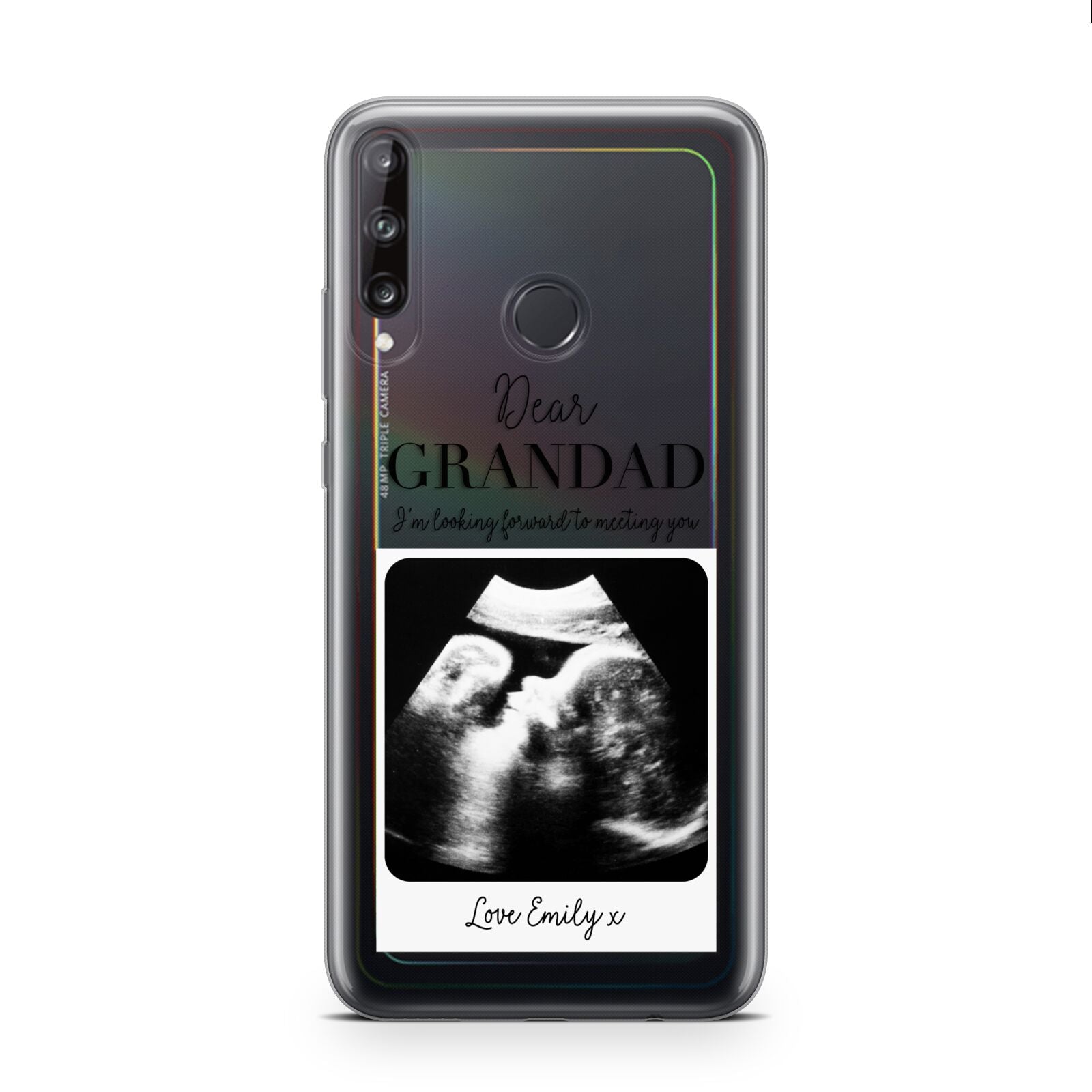 Personalised Baby Scan Photo Upload Huawei P40 Lite E Phone Case