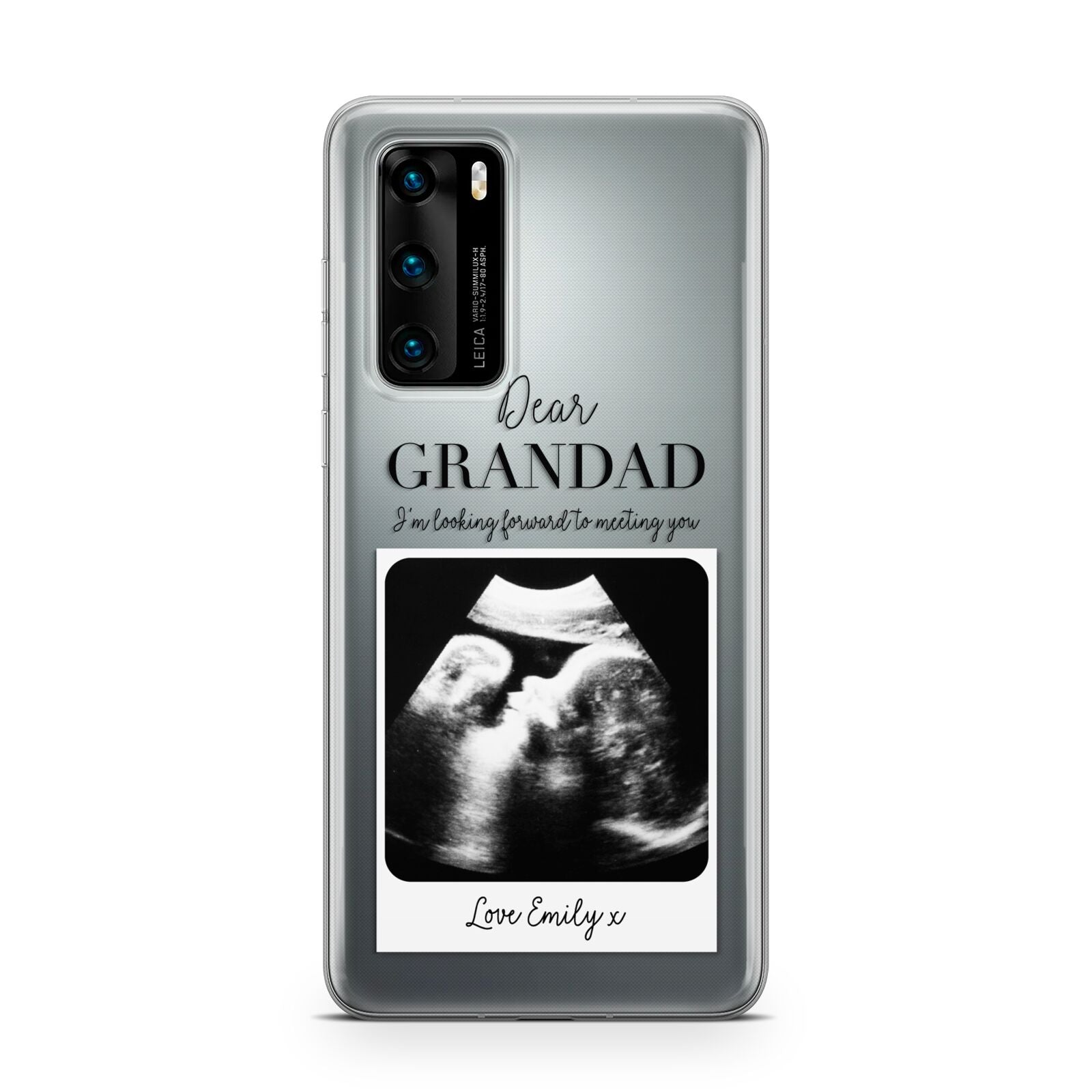 Personalised Baby Scan Photo Upload Huawei P40 Phone Case