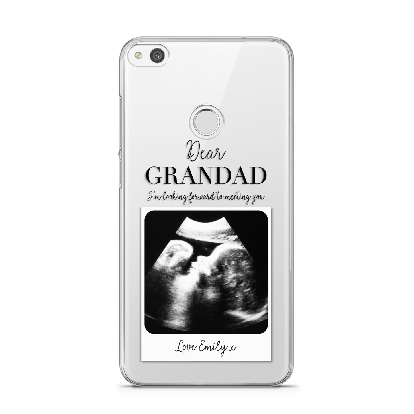 Personalised Baby Scan Photo Upload Huawei P8 Lite Case