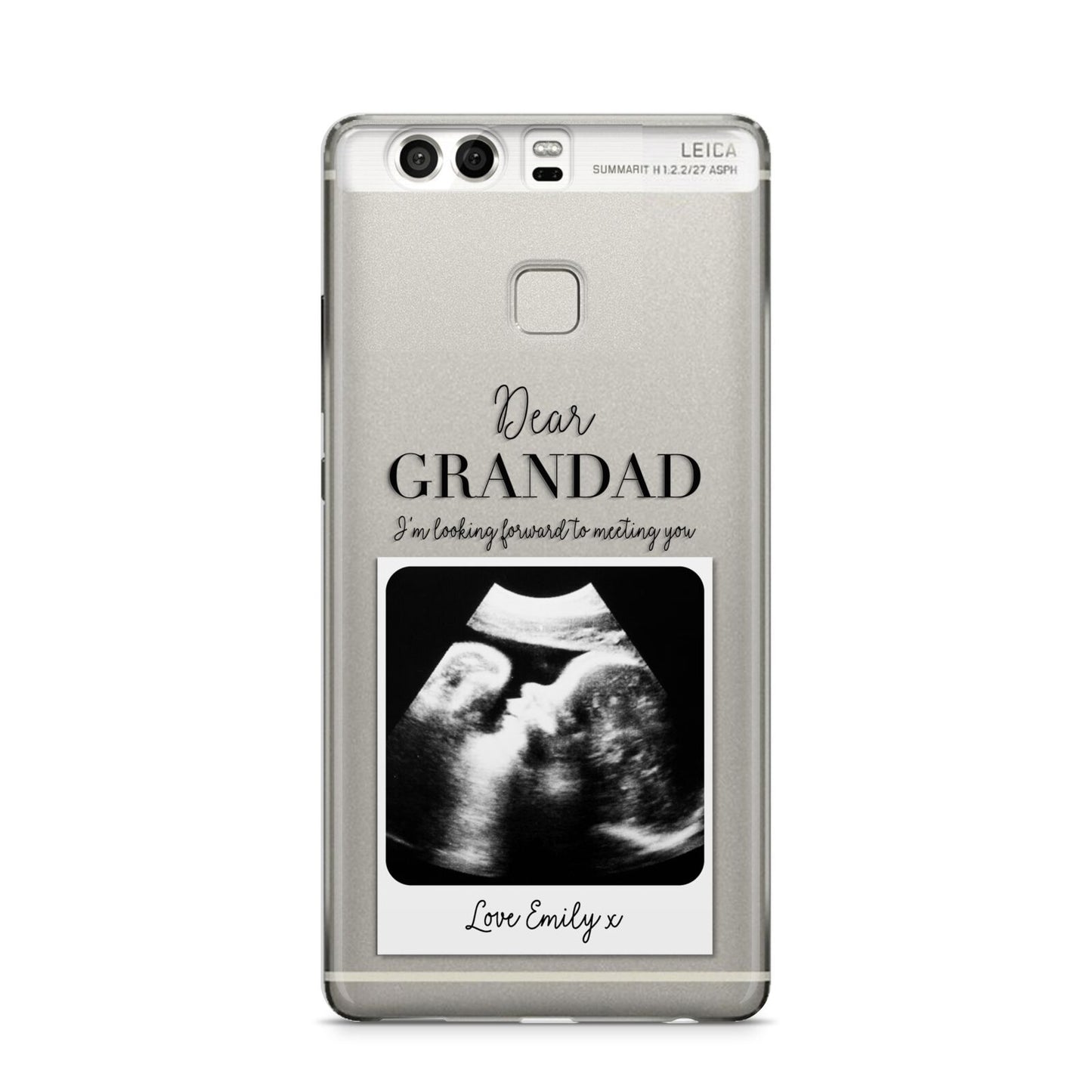 Personalised Baby Scan Photo Upload Huawei P9 Case