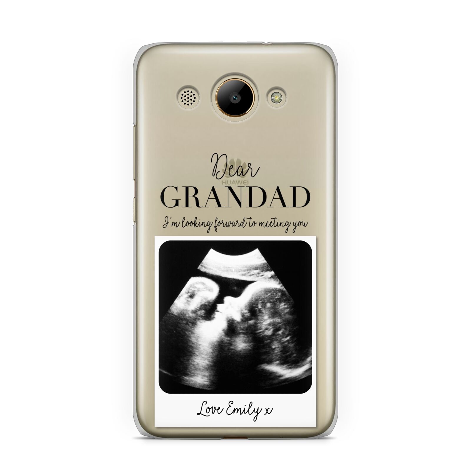 Personalised Baby Scan Photo Upload Huawei Y3 2017