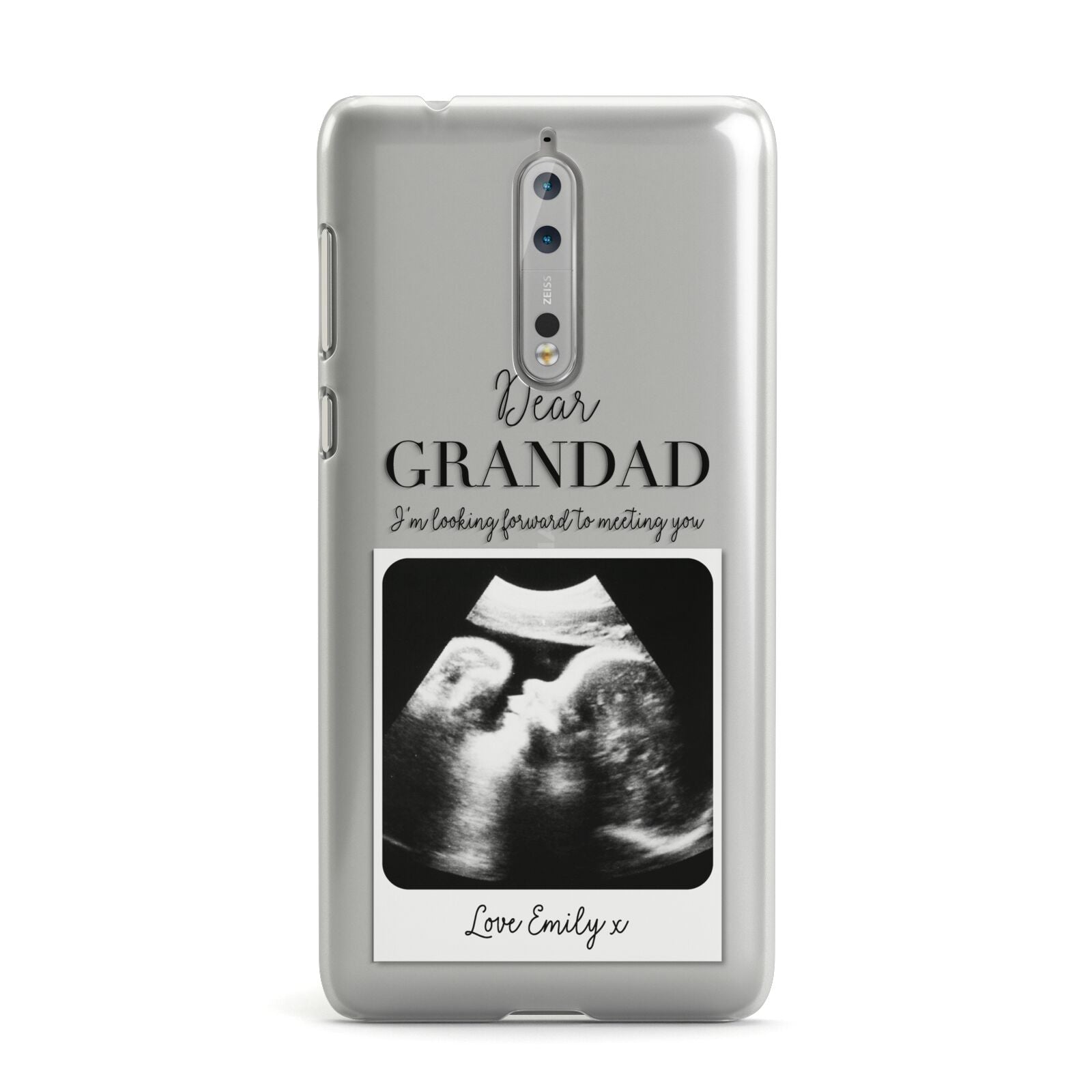 Personalised Baby Scan Photo Upload Nokia Case Dyefor