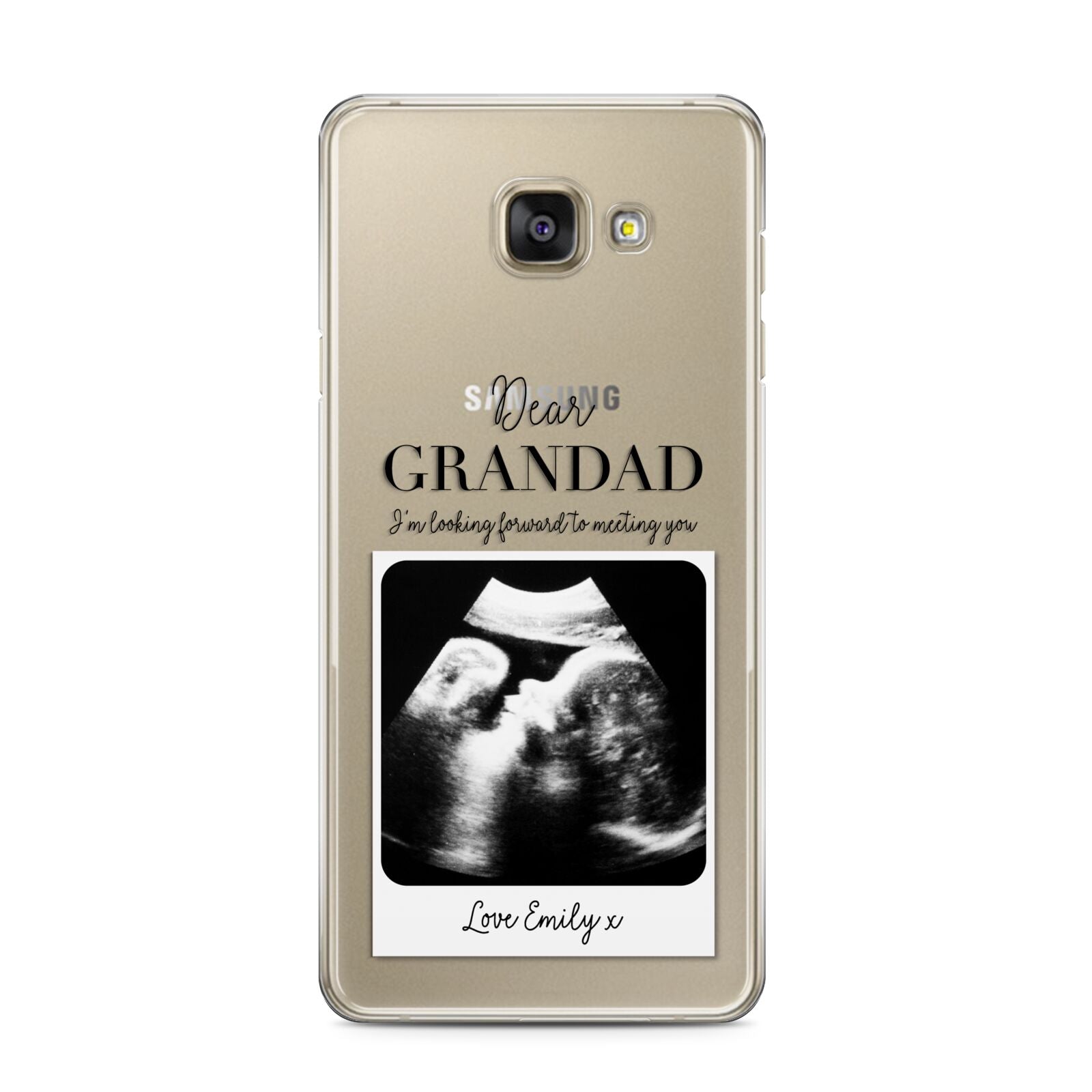 Personalised Baby Scan Photo Upload Samsung Galaxy A3 2016 Case on gold phone