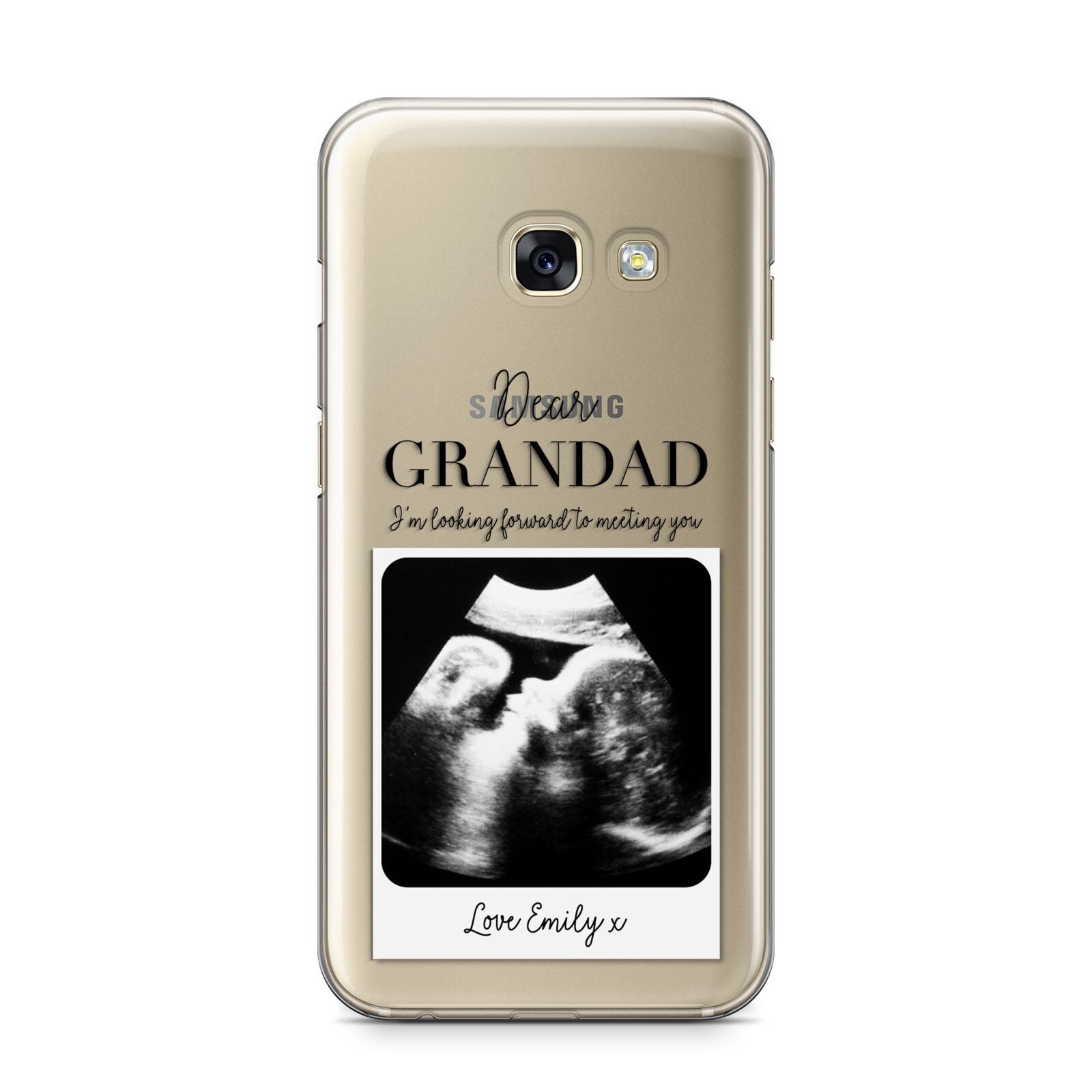 Personalised Baby Scan Photo Upload Samsung Galaxy A3 2017 Case on gold phone