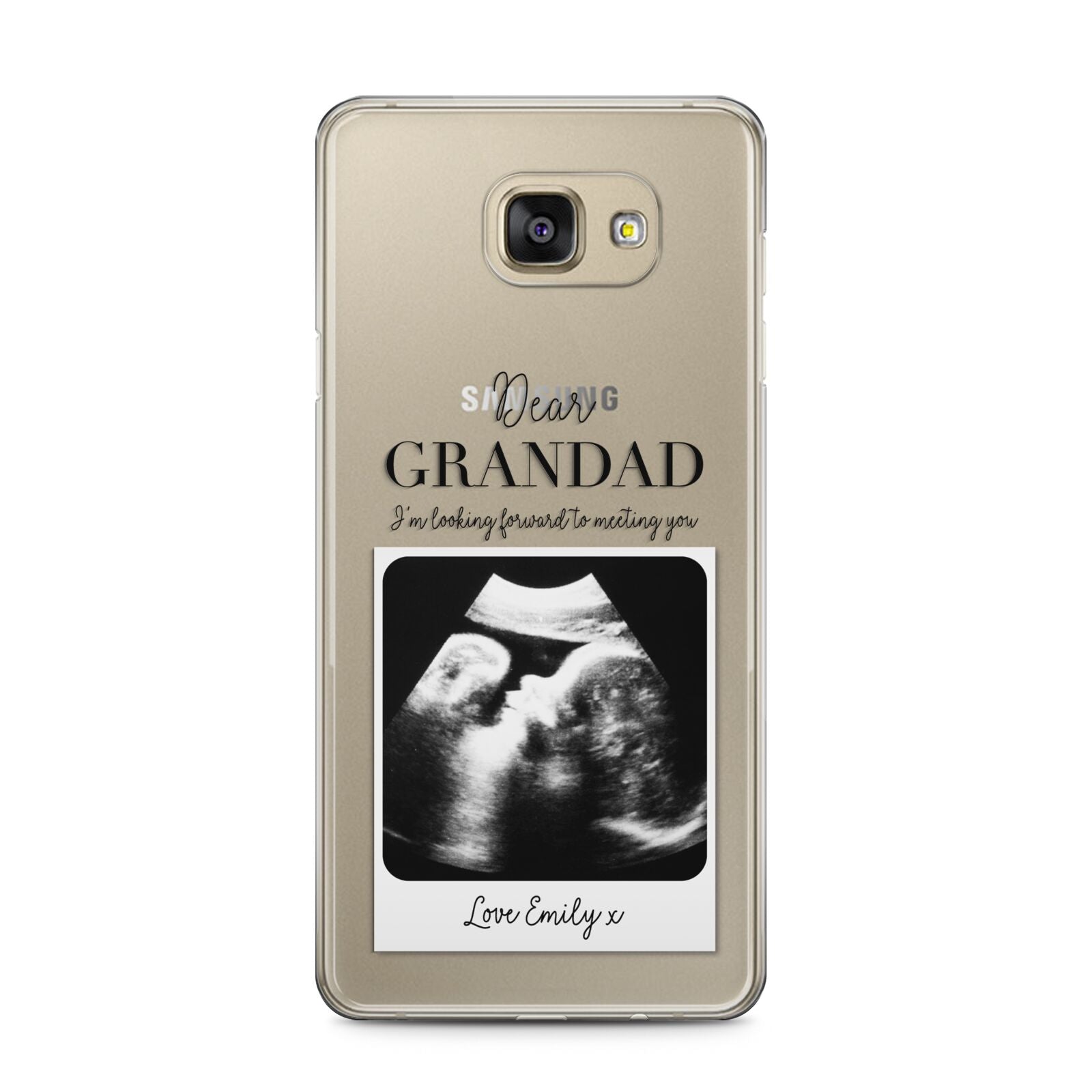 Personalised Baby Scan Photo Upload Samsung Galaxy A5 2016 Case on gold phone