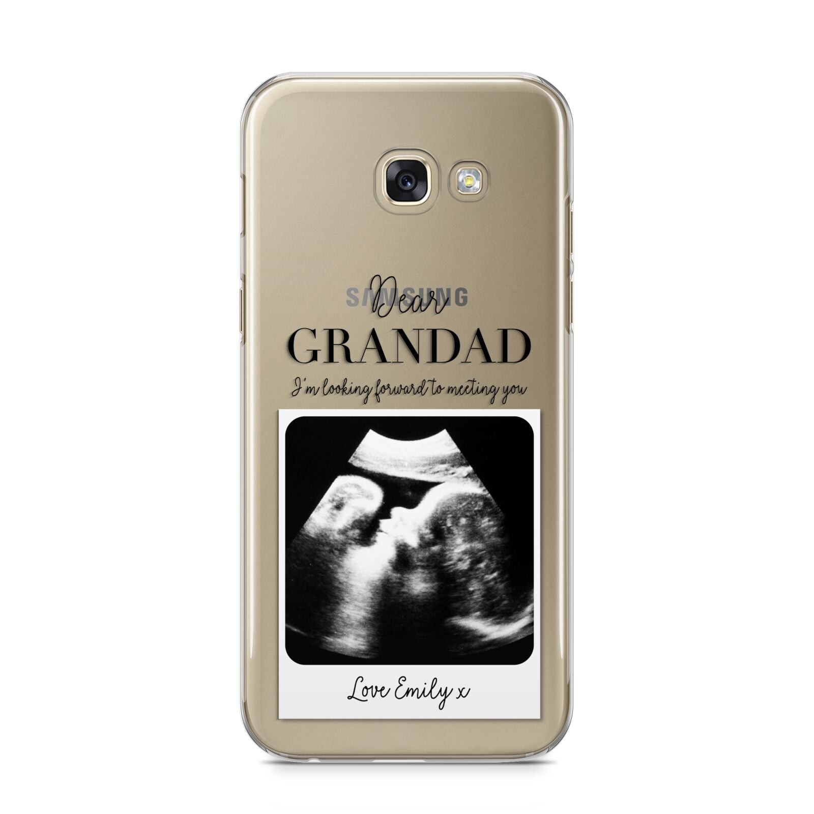 Personalised Baby Scan Photo Upload Samsung Galaxy A5 2017 Case on gold phone