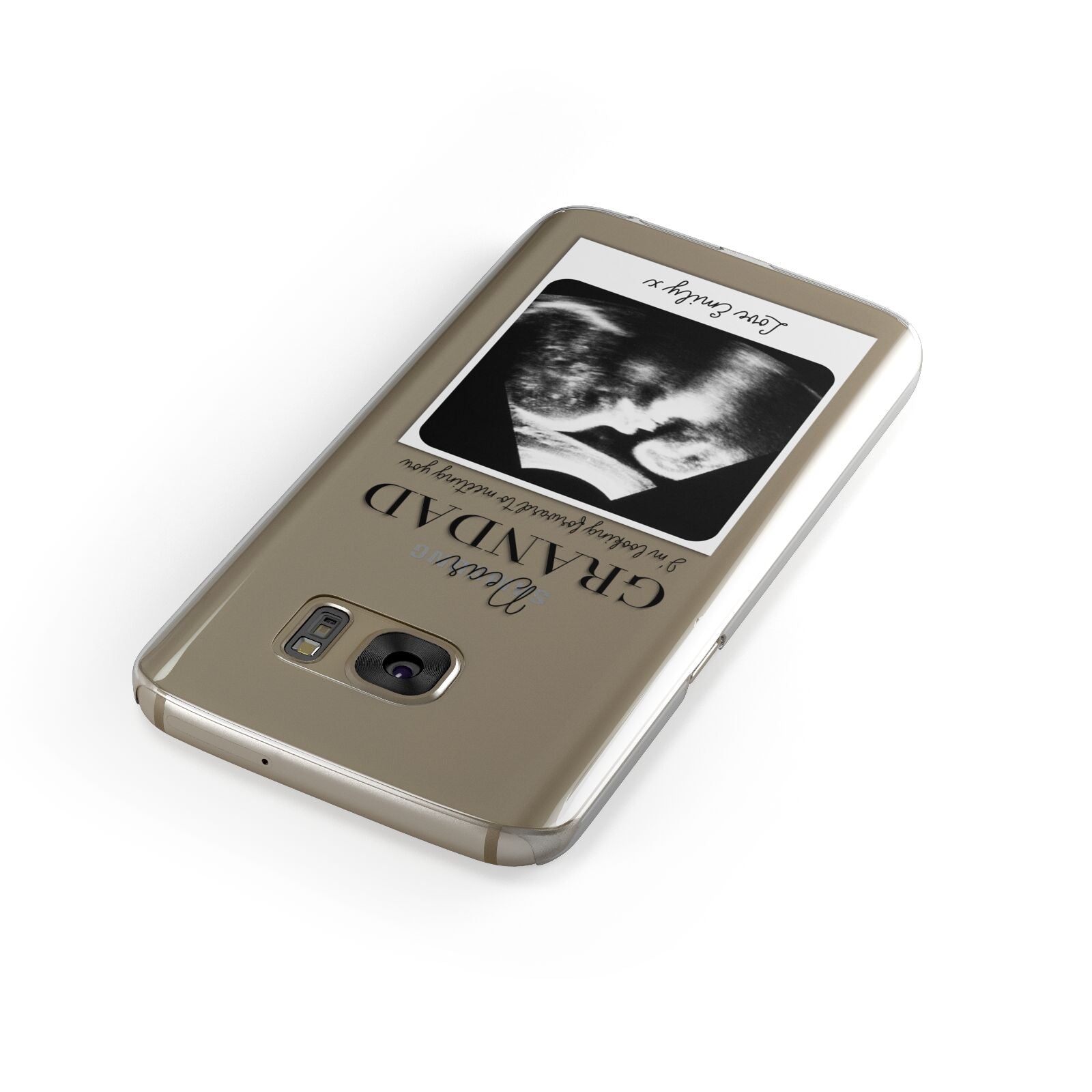 Personalised Baby Scan Photo Upload Samsung Galaxy Case Front Close Up