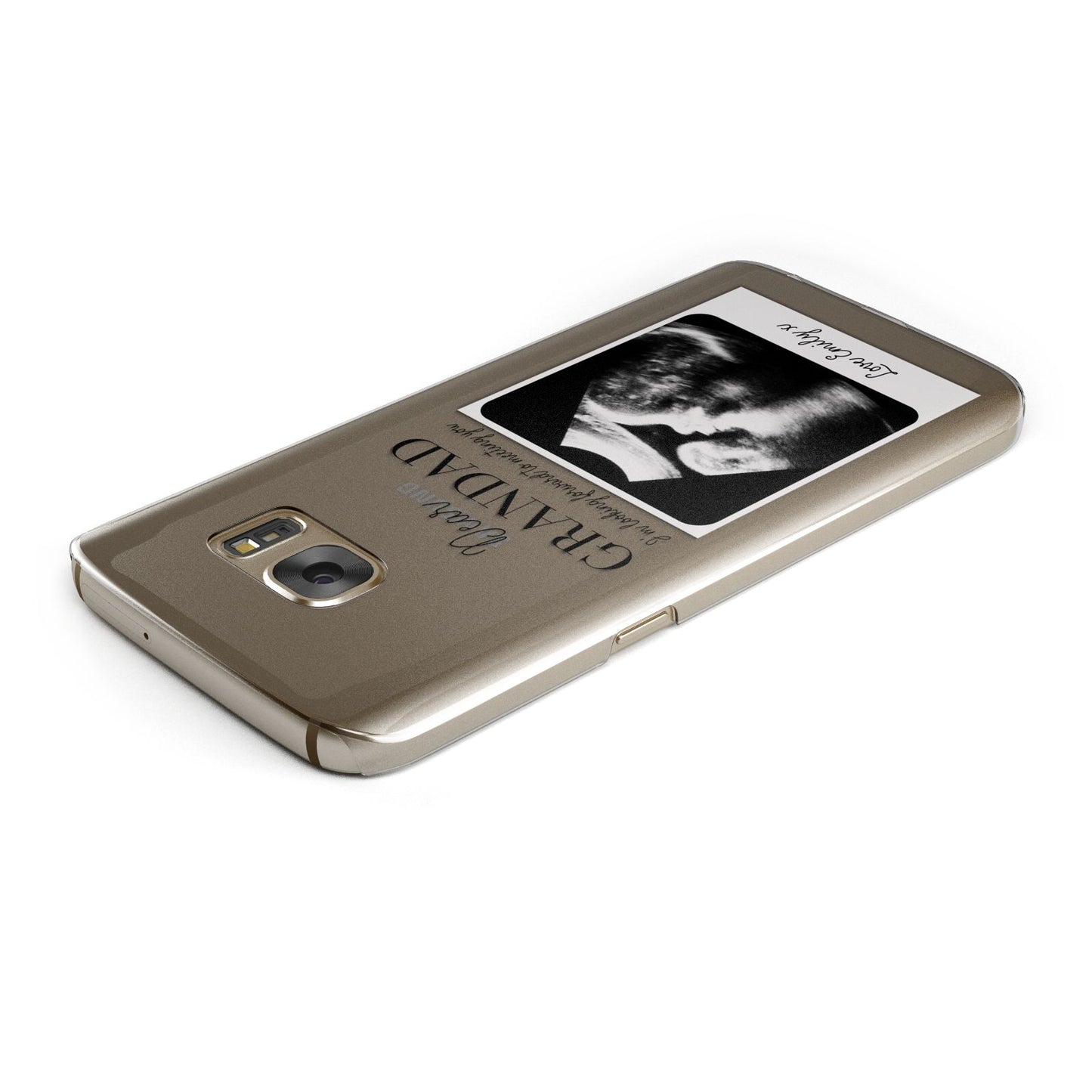 Personalised Baby Scan Photo Upload Samsung Galaxy Case Top Cutout