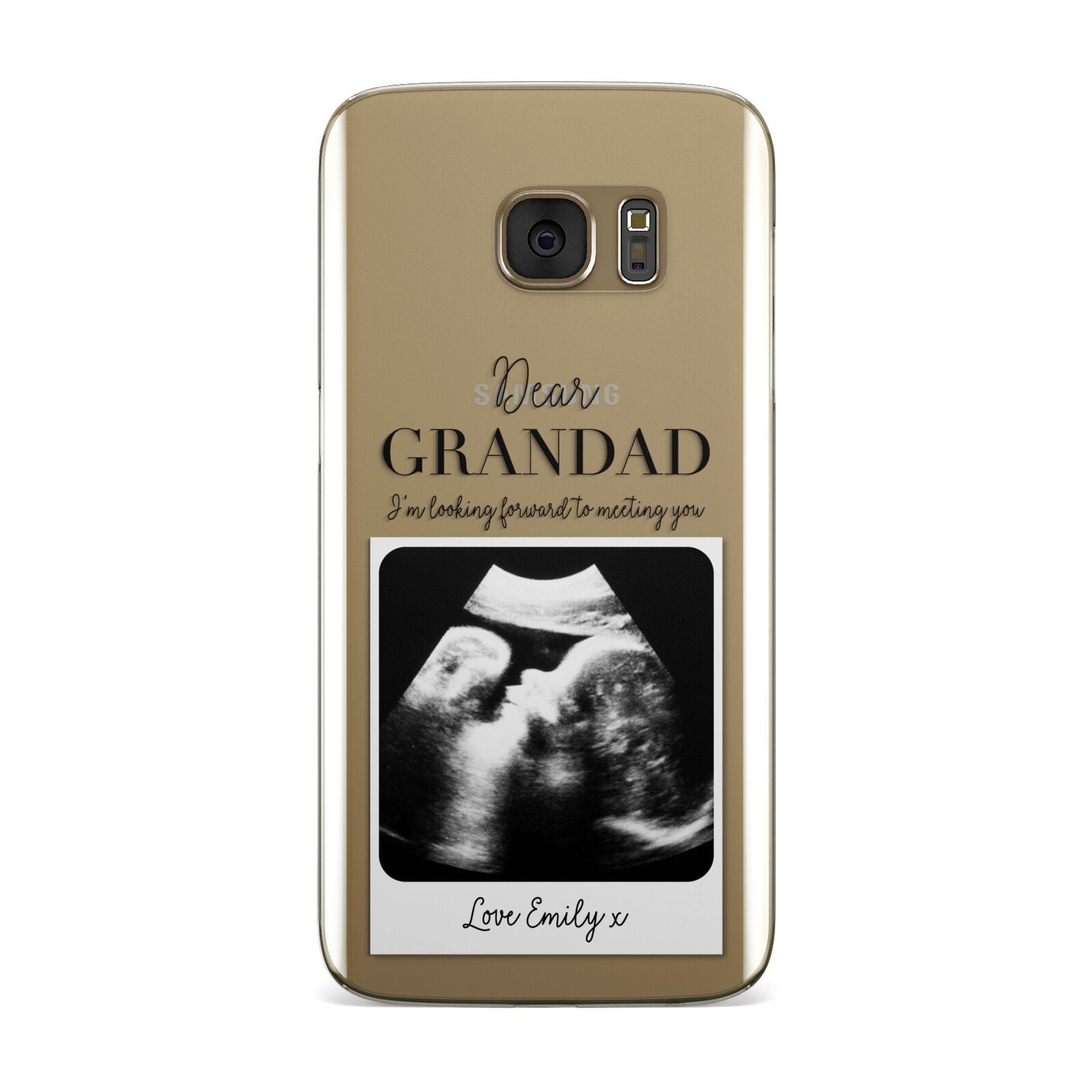 Personalised Baby Scan Photo Upload Samsung Galaxy Case