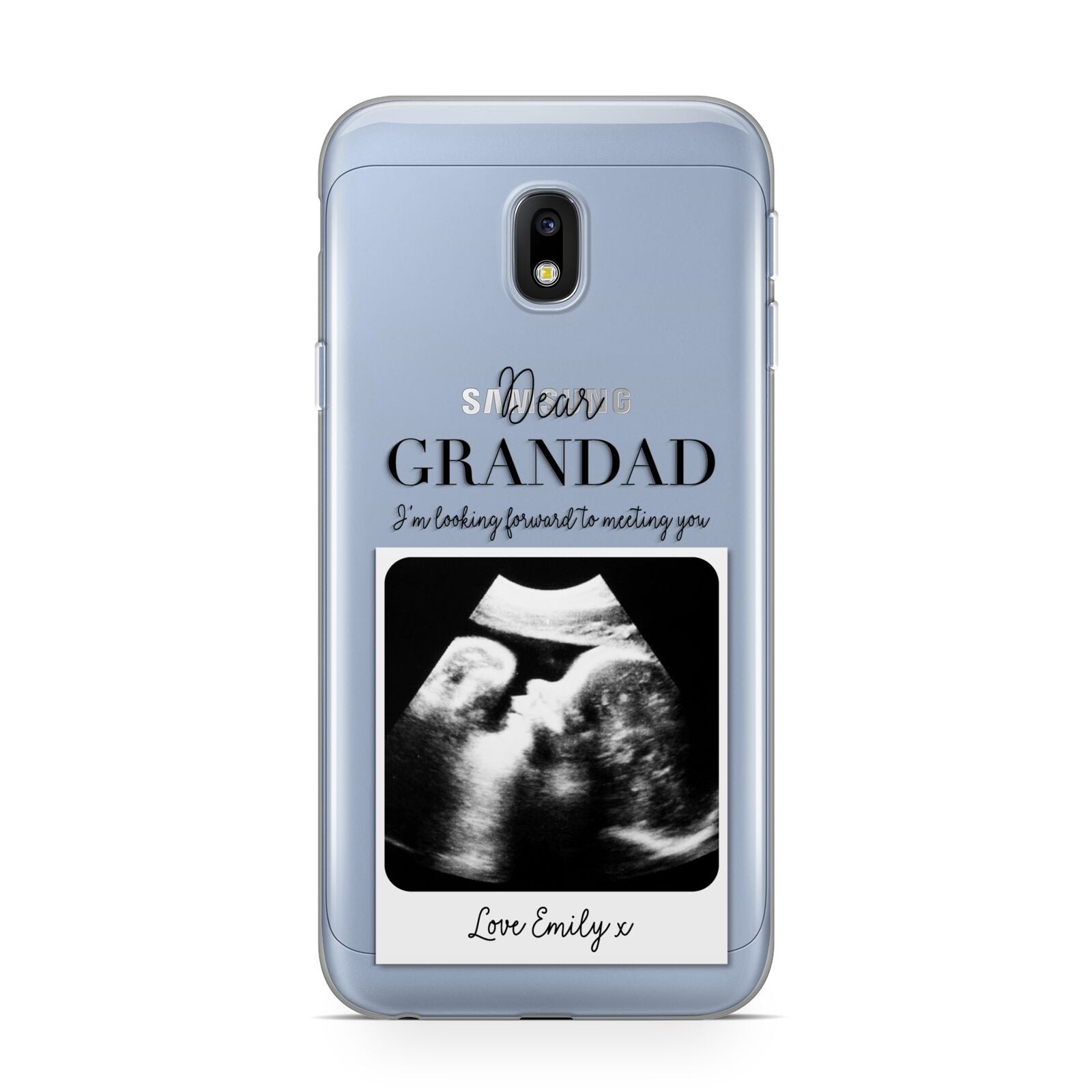 Personalised Baby Scan Photo Upload Samsung Galaxy J3 2017 Case