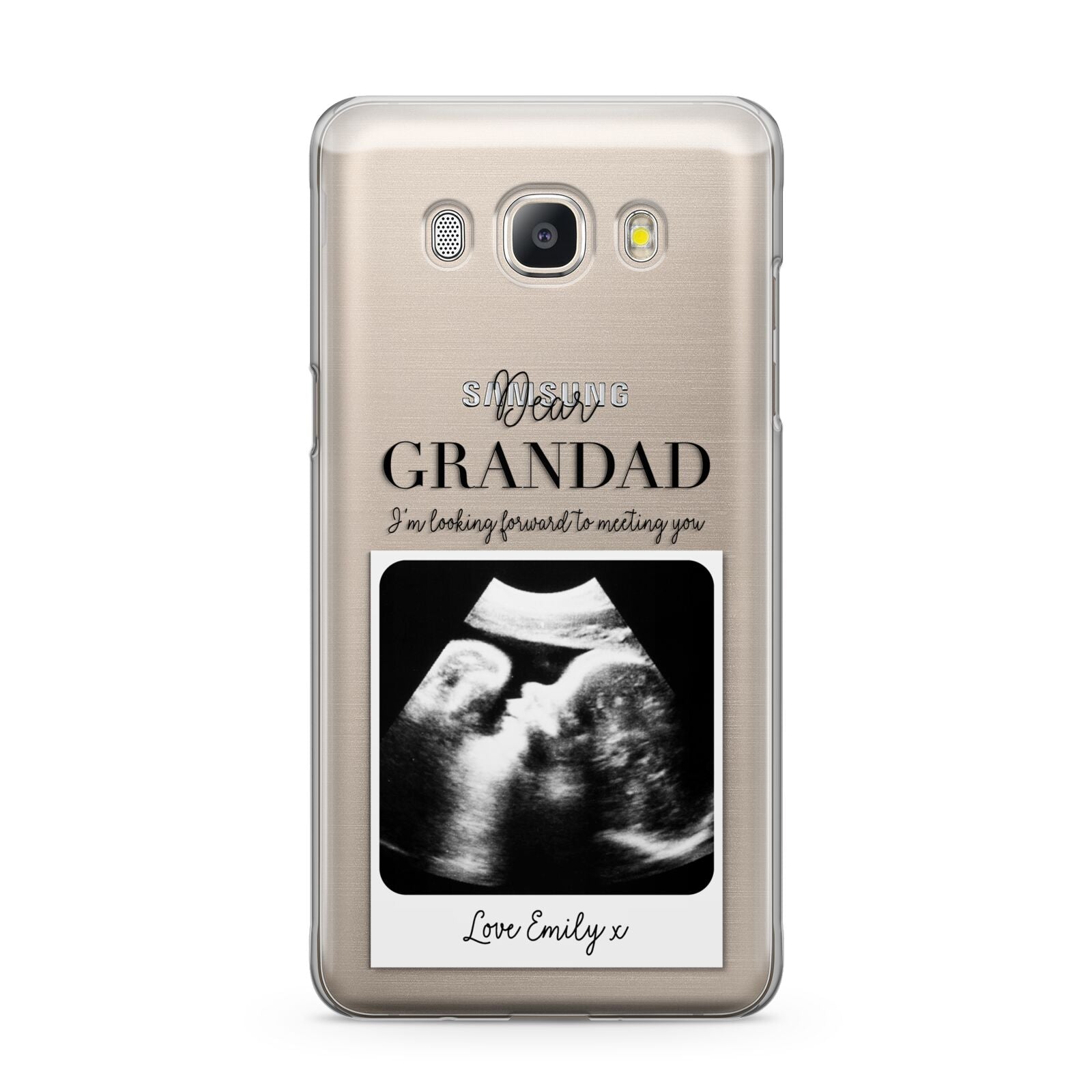 Personalised Baby Scan Photo Upload Samsung Galaxy J5 2016 Case