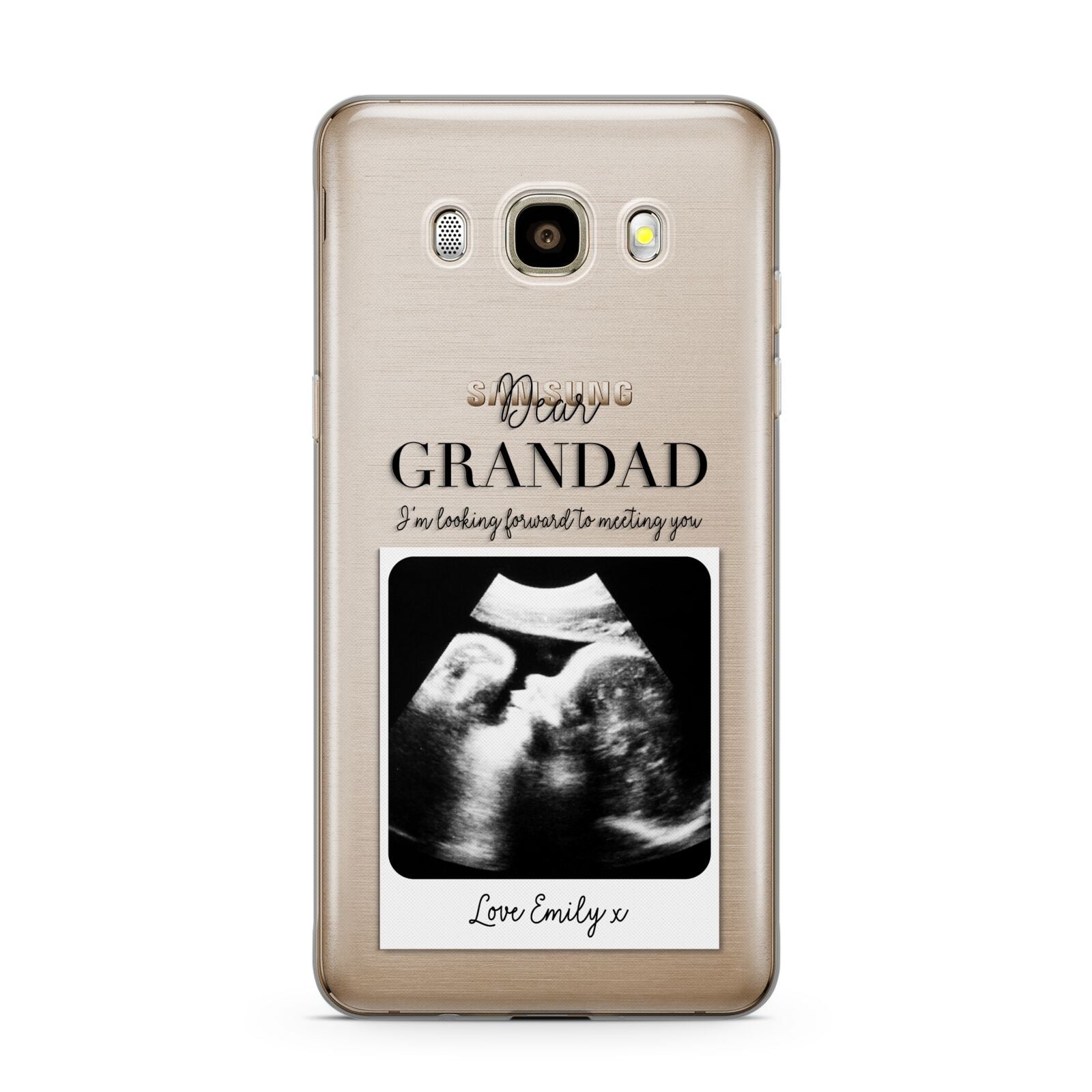 Personalised Baby Scan Photo Upload Samsung Galaxy J7 2016 Case on gold phone