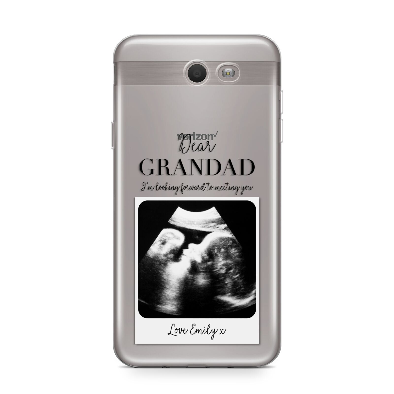 Personalised Baby Scan Photo Upload Samsung Galaxy J7 2017 Case