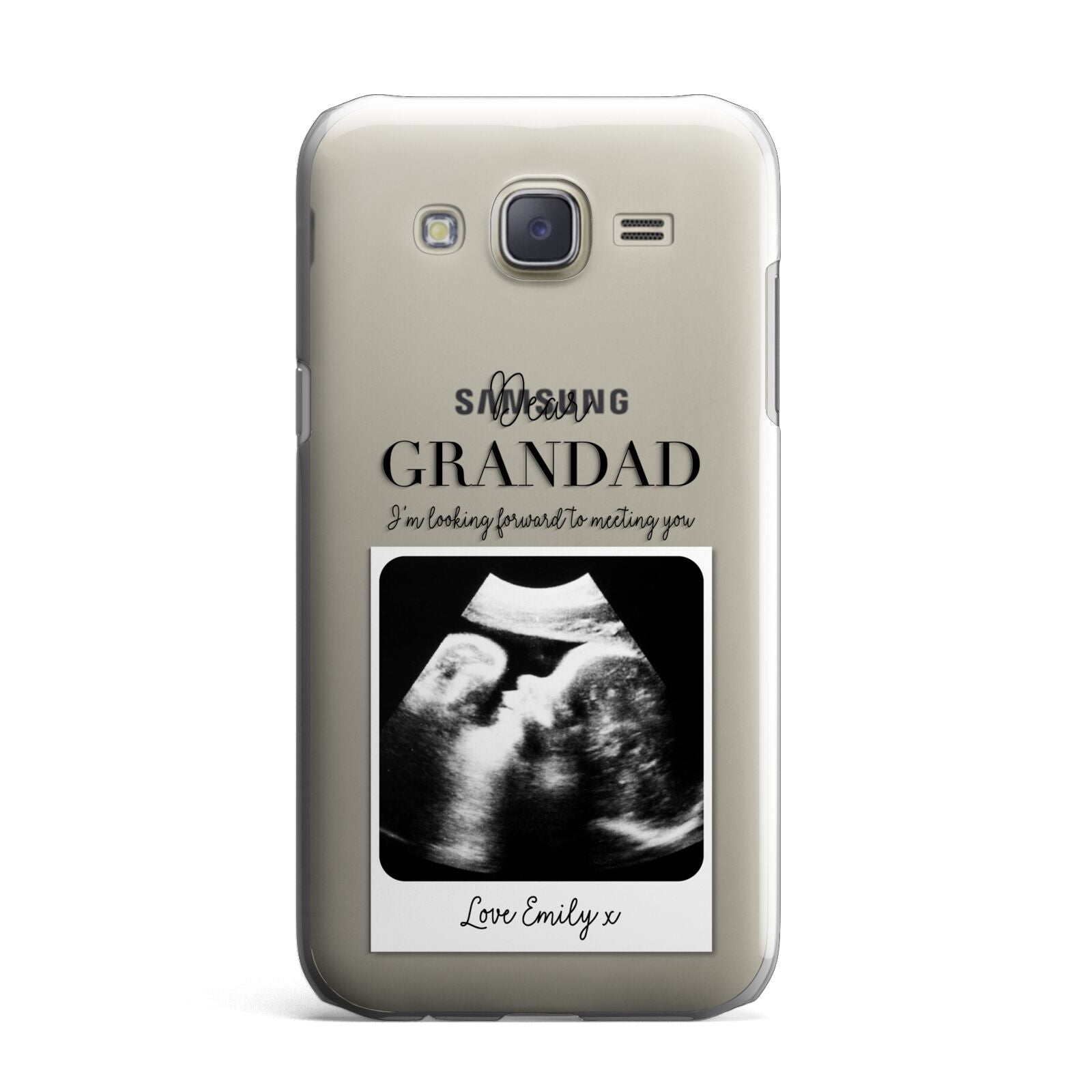 Personalised Baby Scan Photo Upload Samsung Galaxy J7 Case