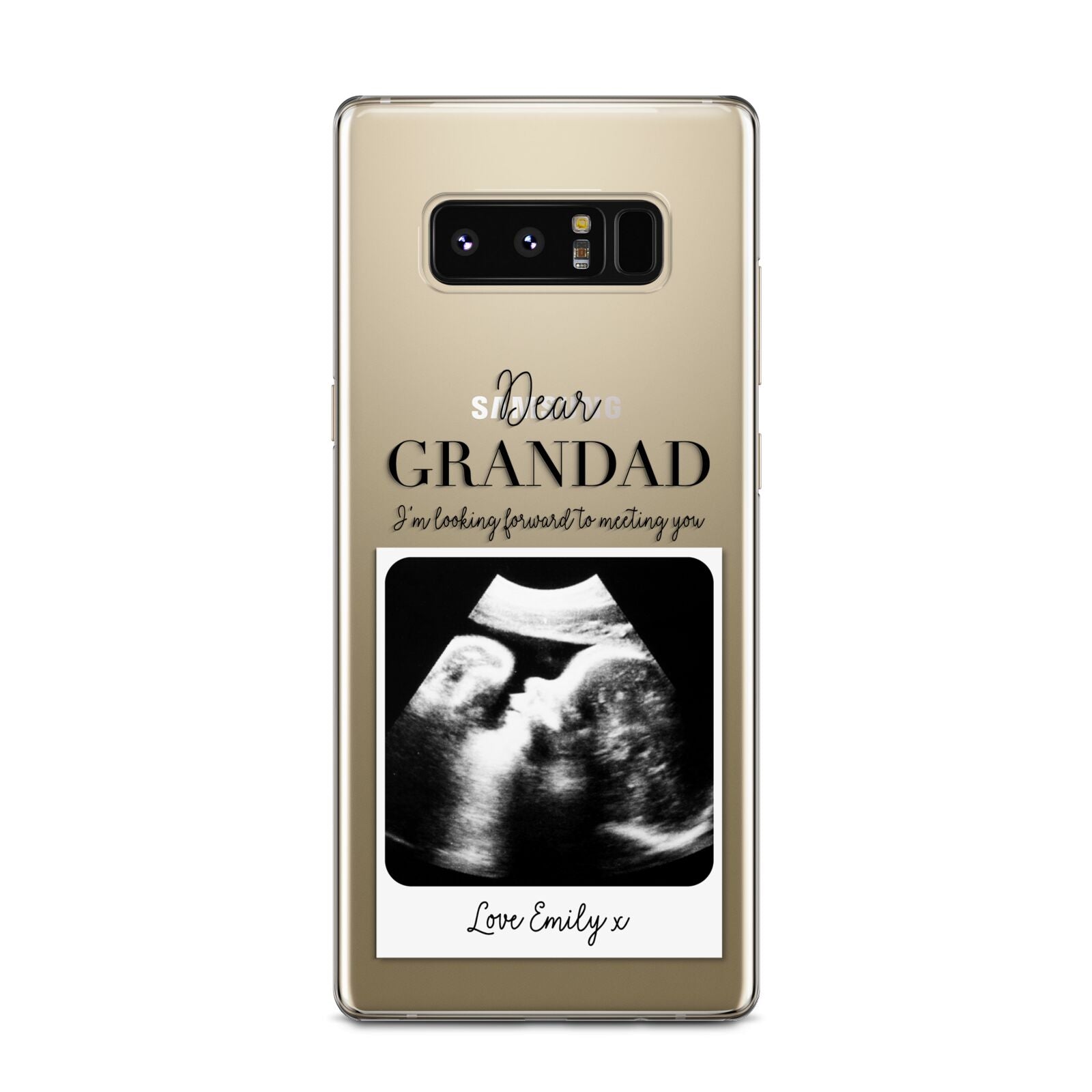 Personalised Baby Scan Photo Upload Samsung Galaxy Note 8 Case