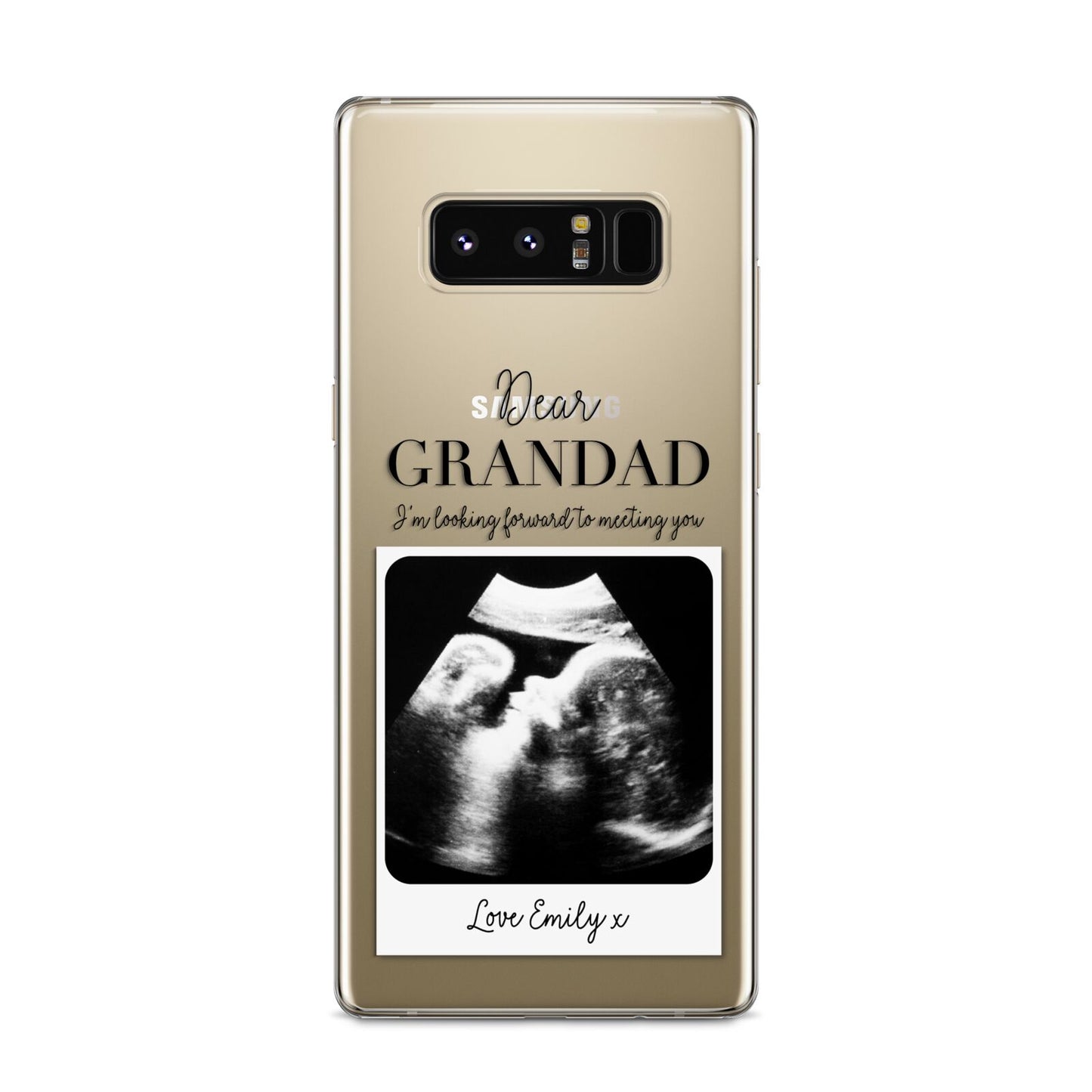 Personalised Baby Scan Photo Upload Samsung Galaxy S8 Case