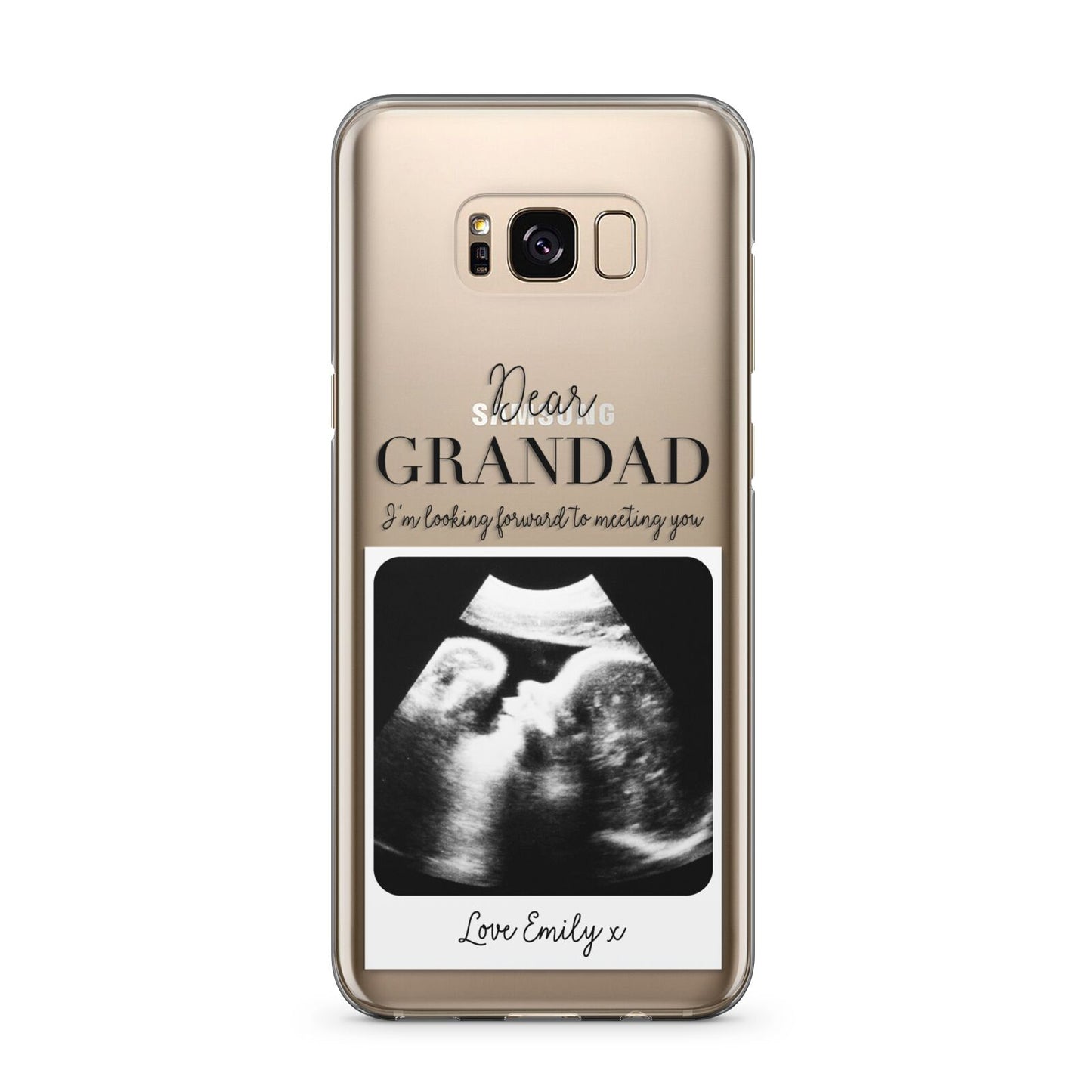 Personalised Baby Scan Photo Upload Samsung Galaxy S8 Plus Case