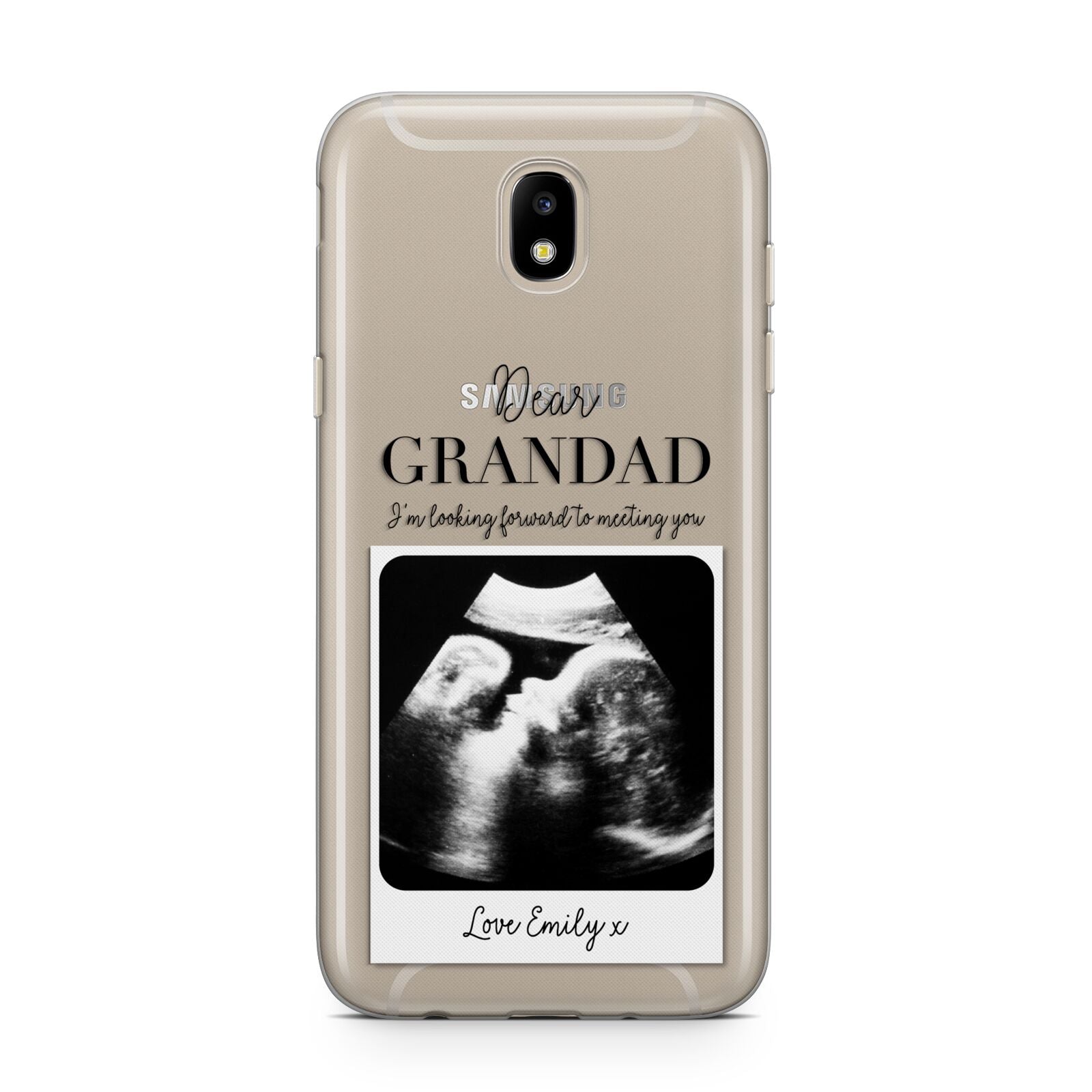 Personalised Baby Scan Photo Upload Samsung J5 2017 Case