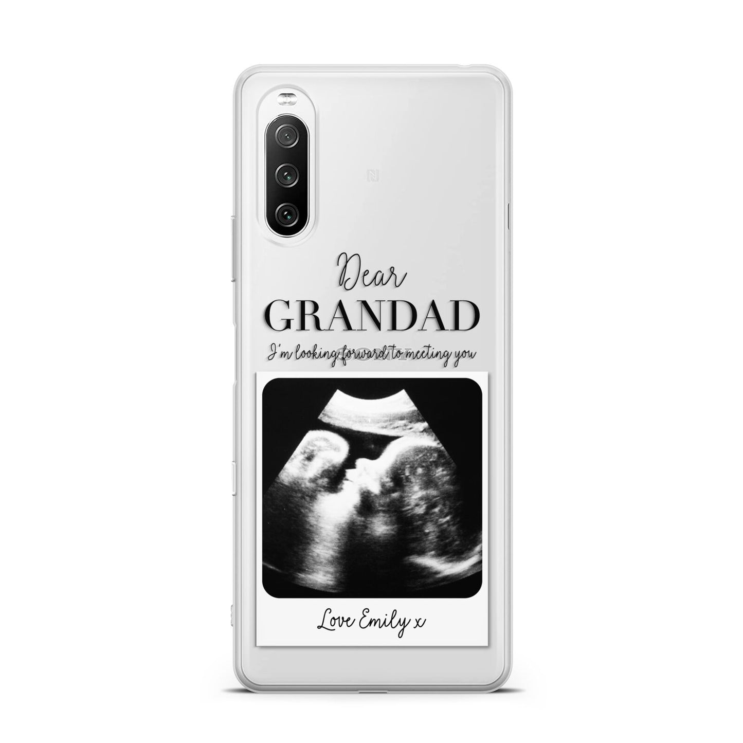 Personalised Baby Scan Photo Upload Sony Xperia 10 III Case