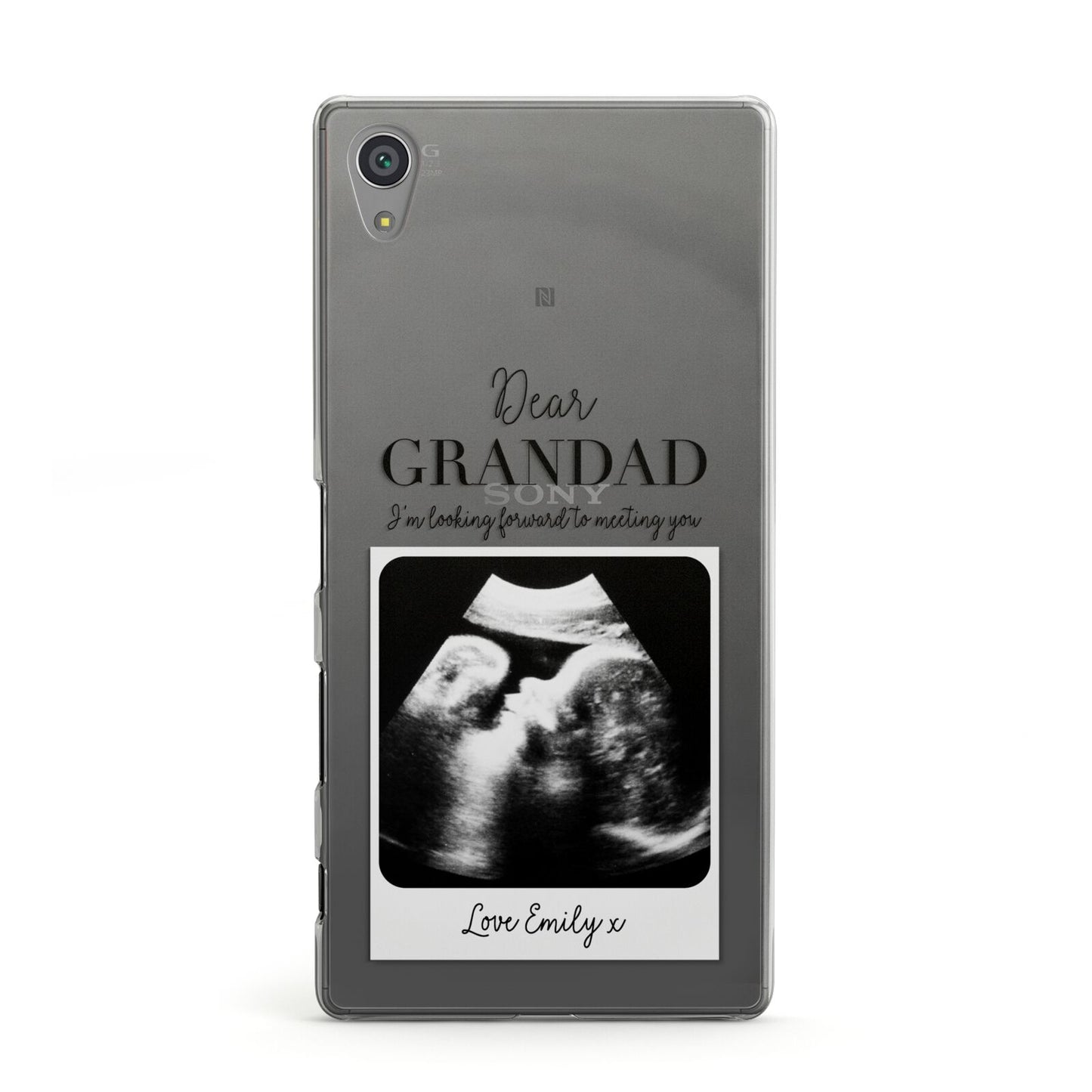 Personalised Baby Scan Photo Upload Sony Xperia Case