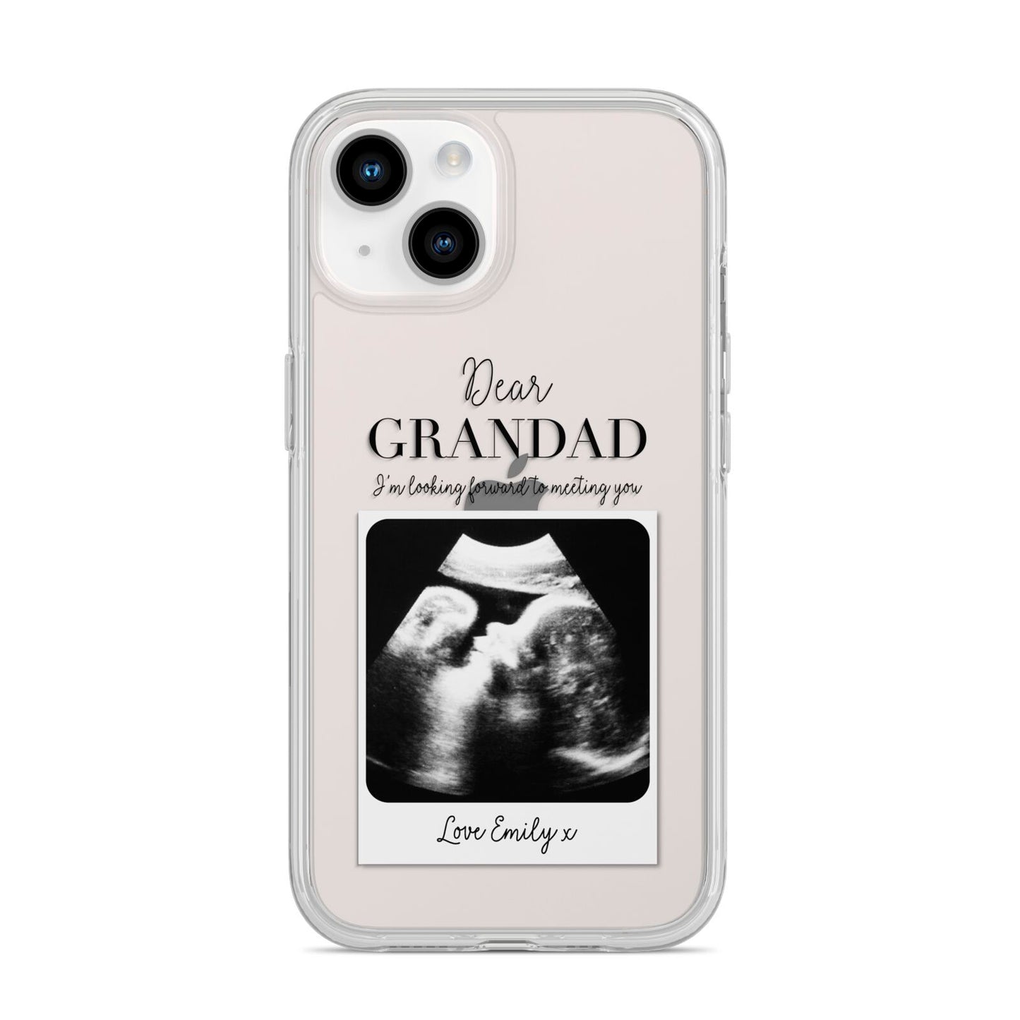 Personalised Baby Scan Photo Upload iPhone 14 Clear Tough Case Starlight