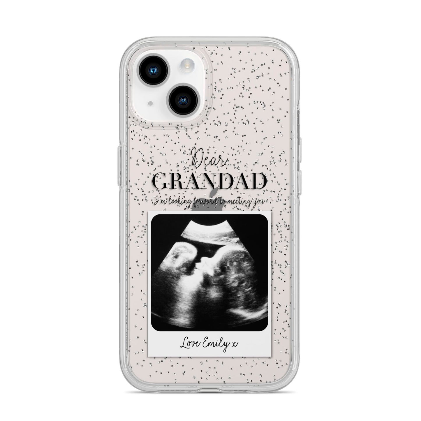 Personalised Baby Scan Photo Upload iPhone 14 Glitter Tough Case Starlight