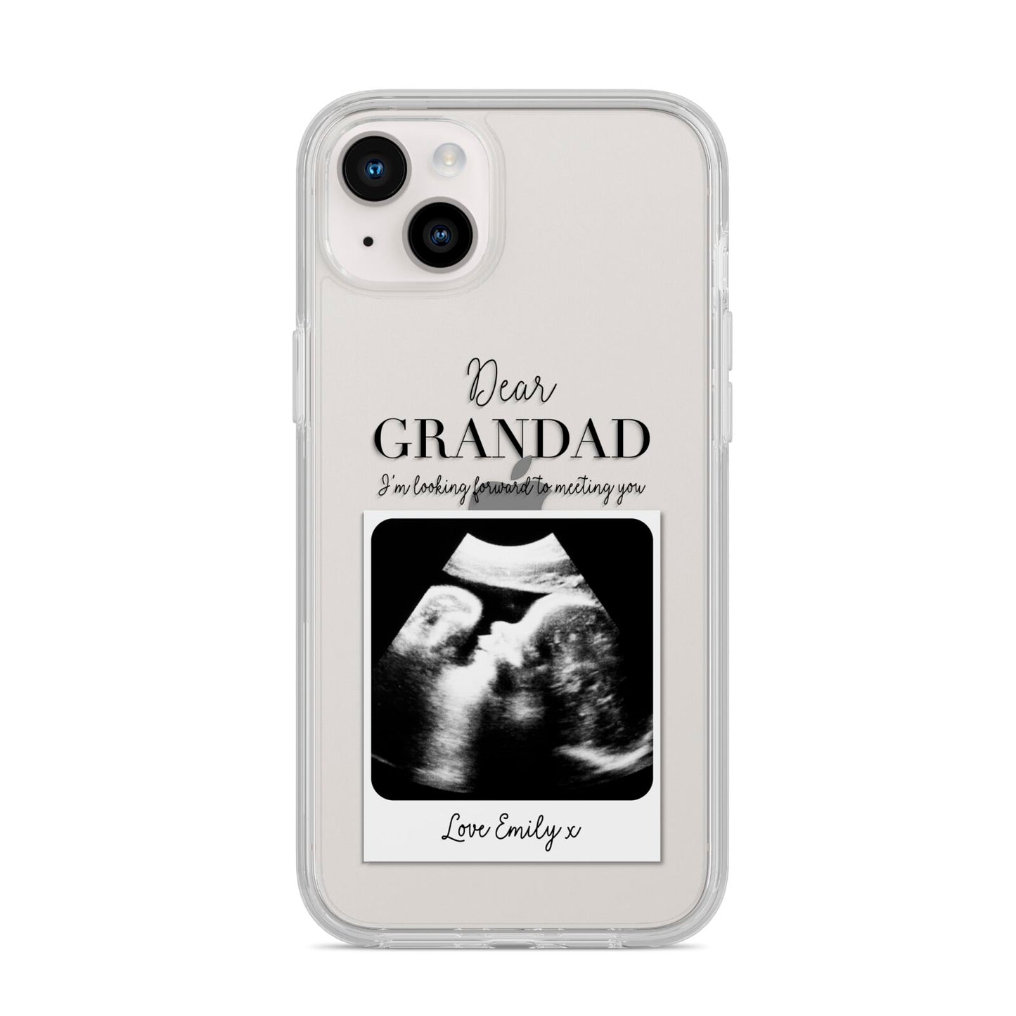 Personalised Baby Scan Photo Upload iPhone 14 Plus Clear Tough Case Starlight