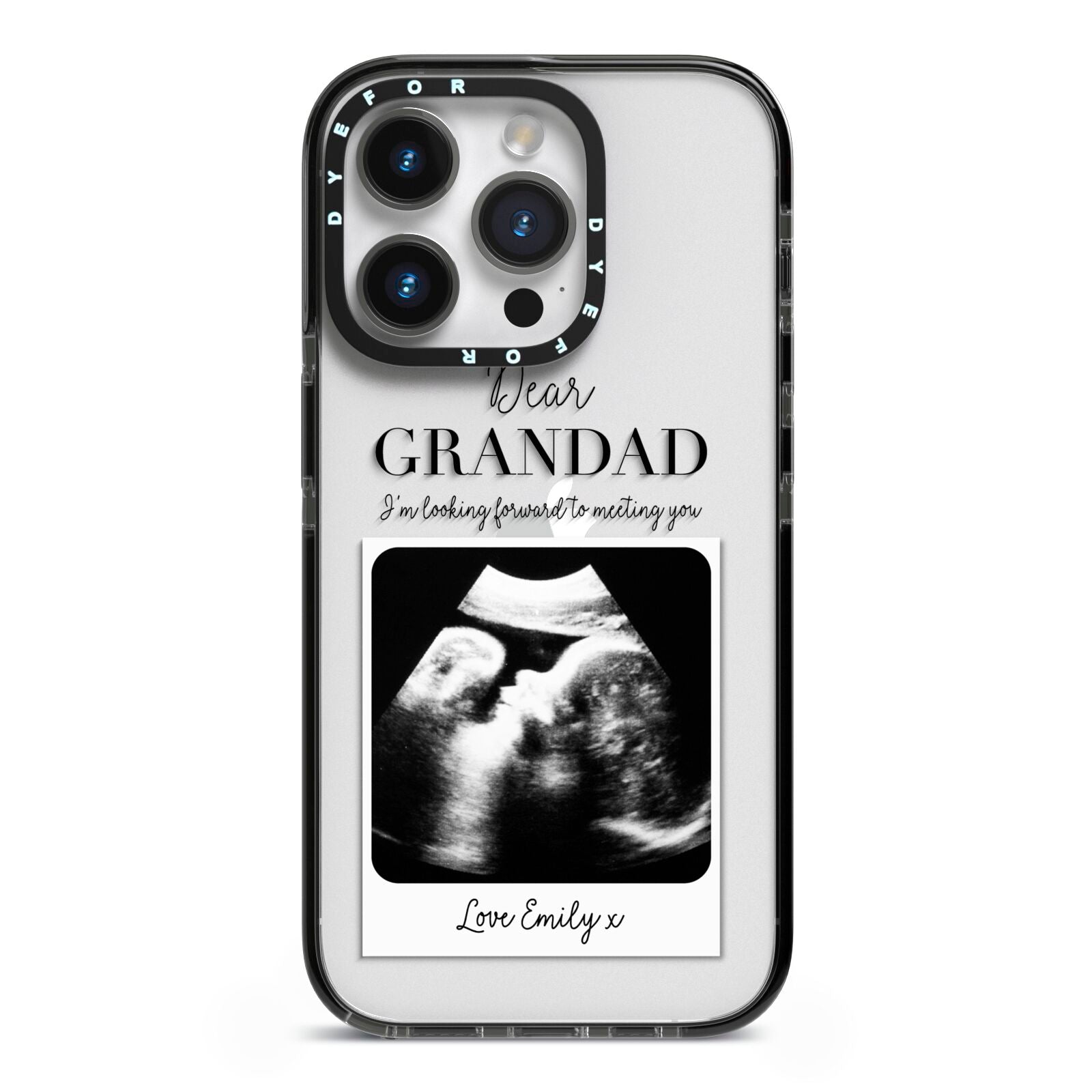 Personalised Baby Scan Photo Upload iPhone 14 Pro Black Impact Case on Silver phone