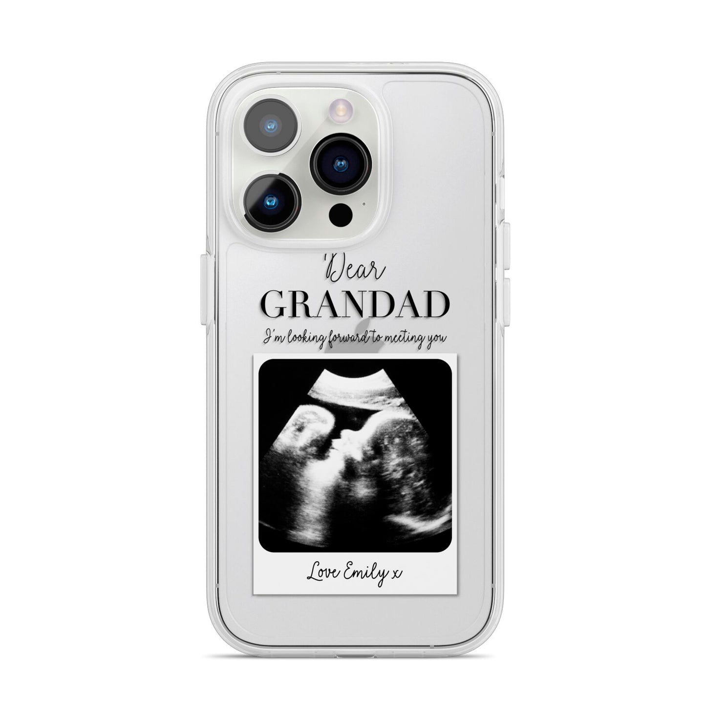 Personalised Baby Scan Photo Upload iPhone 14 Pro Clear Tough Case Silver