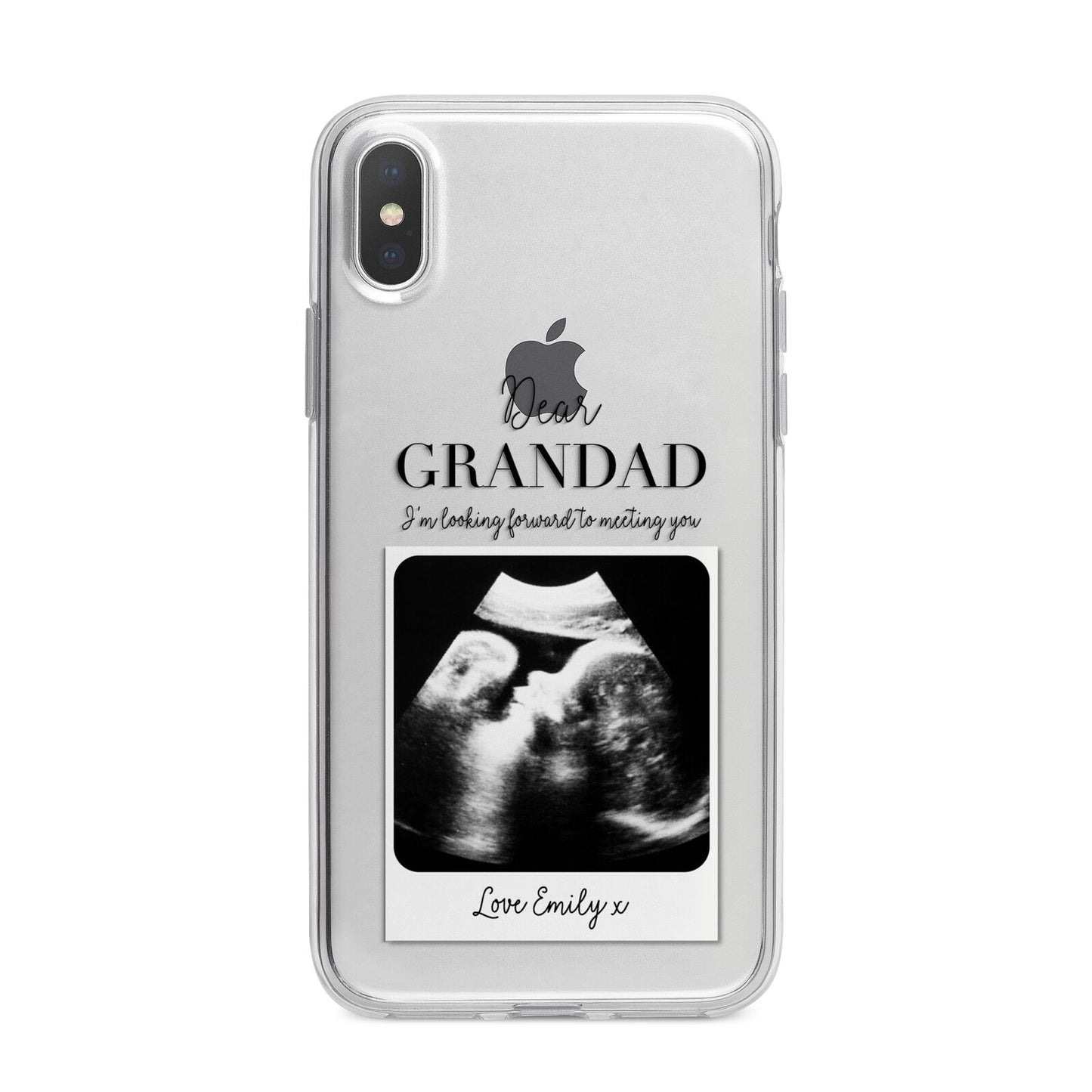 Personalised Baby Scan Photo Upload iPhone X Bumper Case on Silver iPhone Alternative Image 1