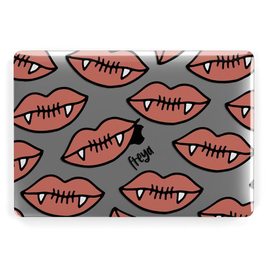 Pink Lips with Fangs Personalised Apple MacBook Case