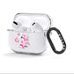 Pink Star AirPods Clear Case 3rd Gen Side Image