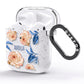 Pretty Floral Custom AirPods Glitter Case Side Image