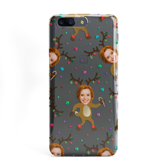 Reindeer Photo Face OnePlus Case