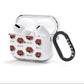 Springador Icon with Name AirPods Clear Case 3rd Gen Side Image