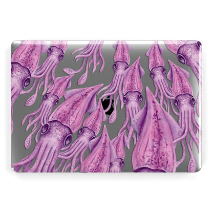 Squid Apple MacBook Case